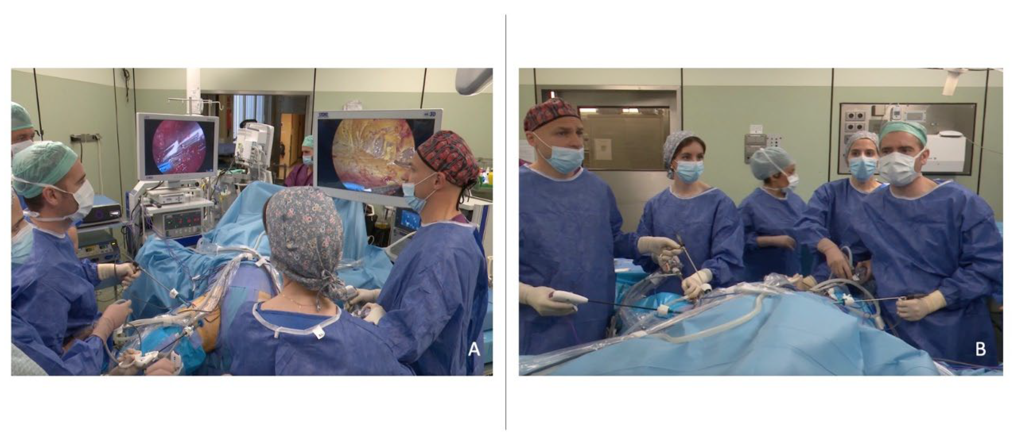 Jcm Free Full Text Simultaneous Bilateral Videoendoscopic Inguinal Lymphadenectomy For 