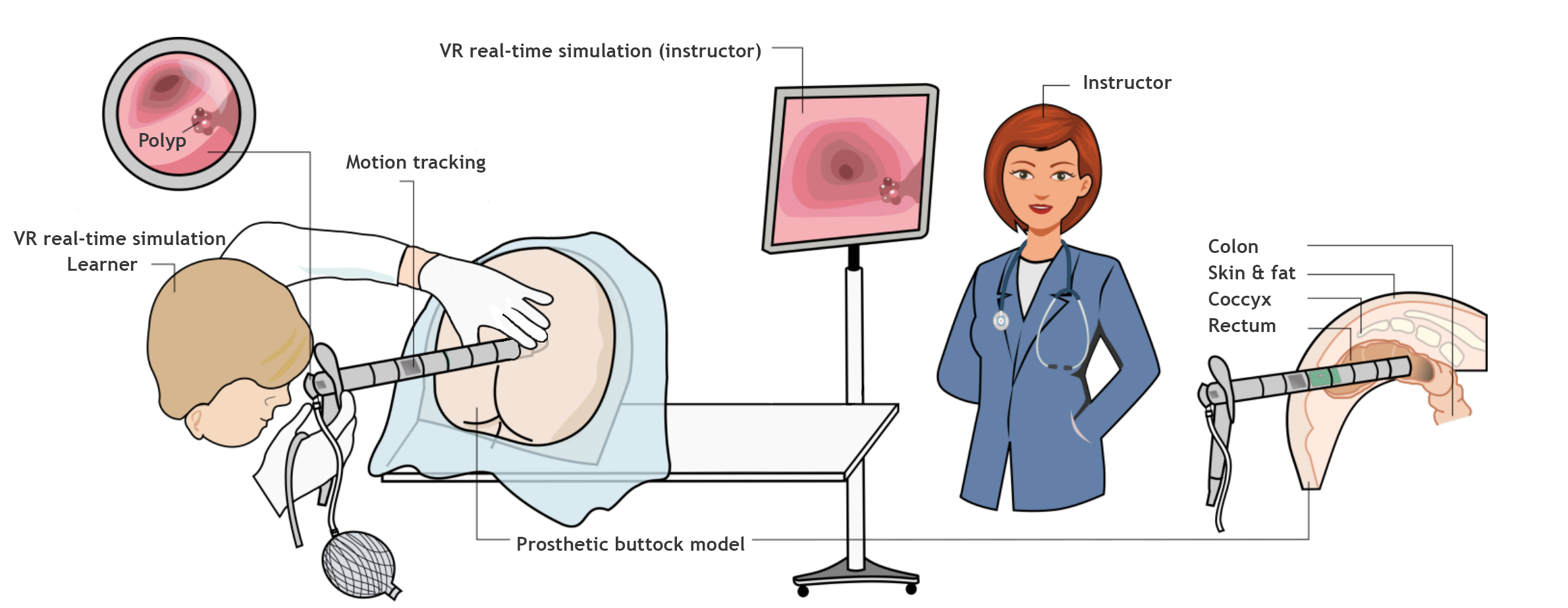 proctoscopy vs colonoscopy