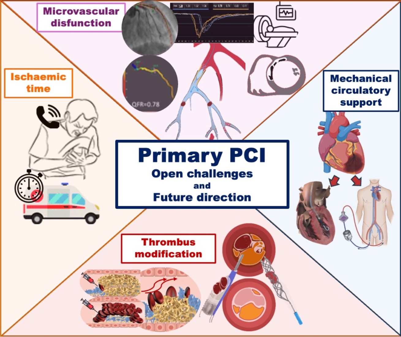 JCM | Free Full-Text | Treatment and Care of Patients with ST-Segment  Elevation Myocardial Infarction—What Challenges Remain after Three  Decades of Primary Percutaneous Coronary Intervention?