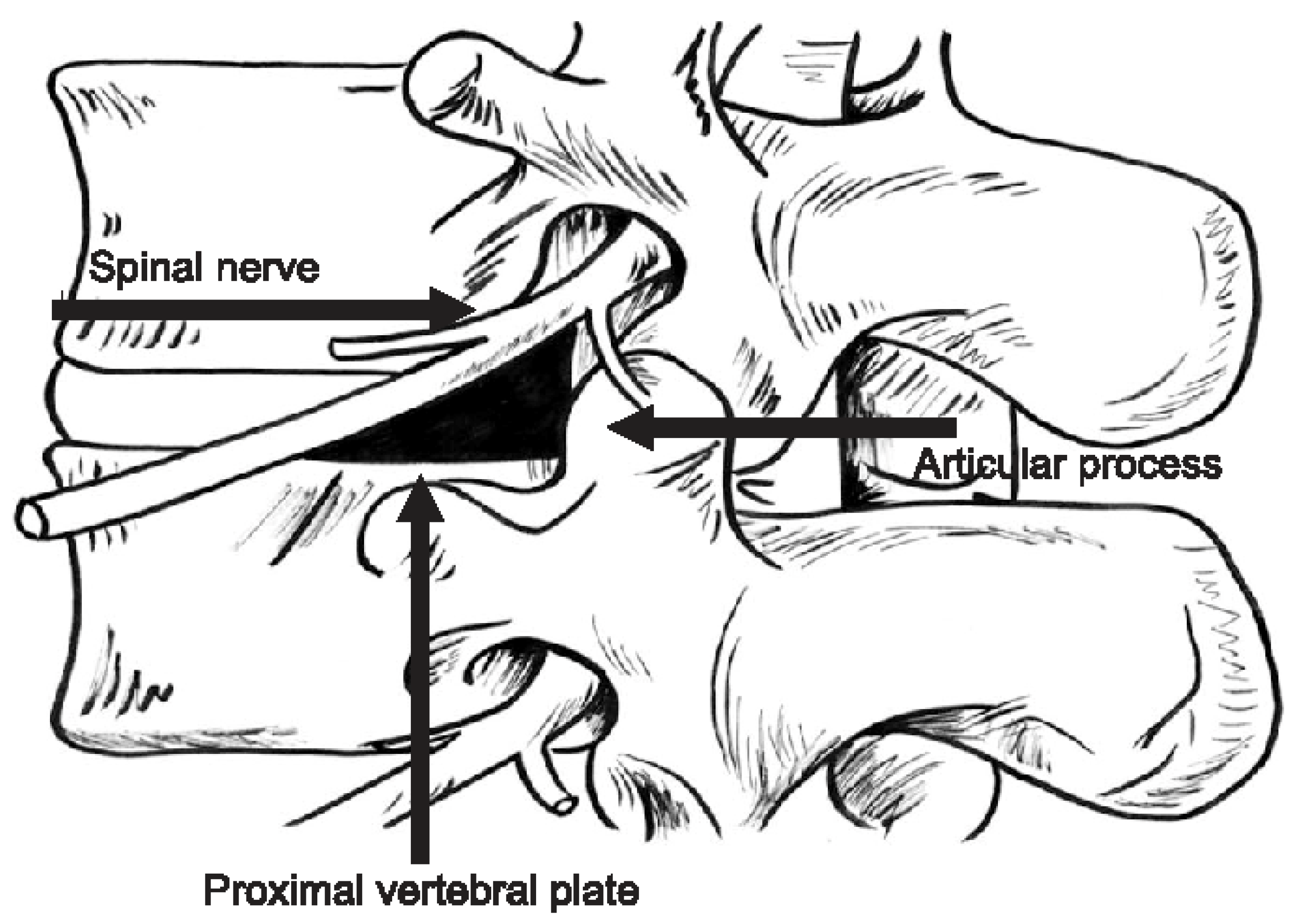 Jcm Free Full Text Advances And Challenges In Minimally Invasive Spine Surgery 