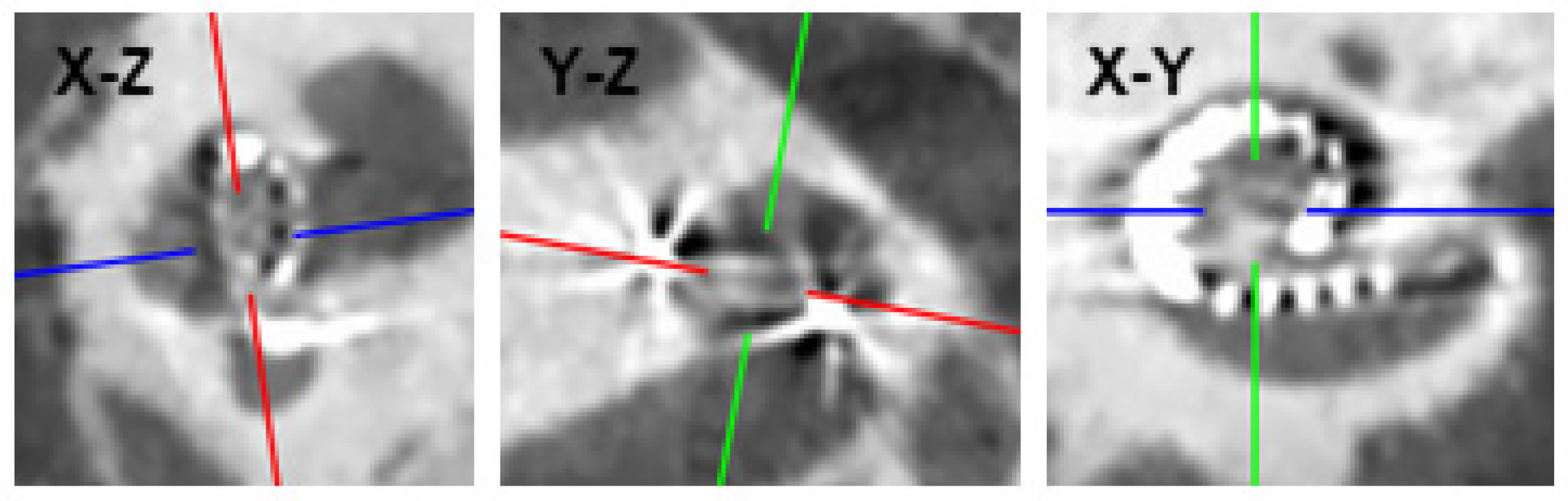 ZH-ECochG Bode Plot: A Novel Approach to Visualize ...