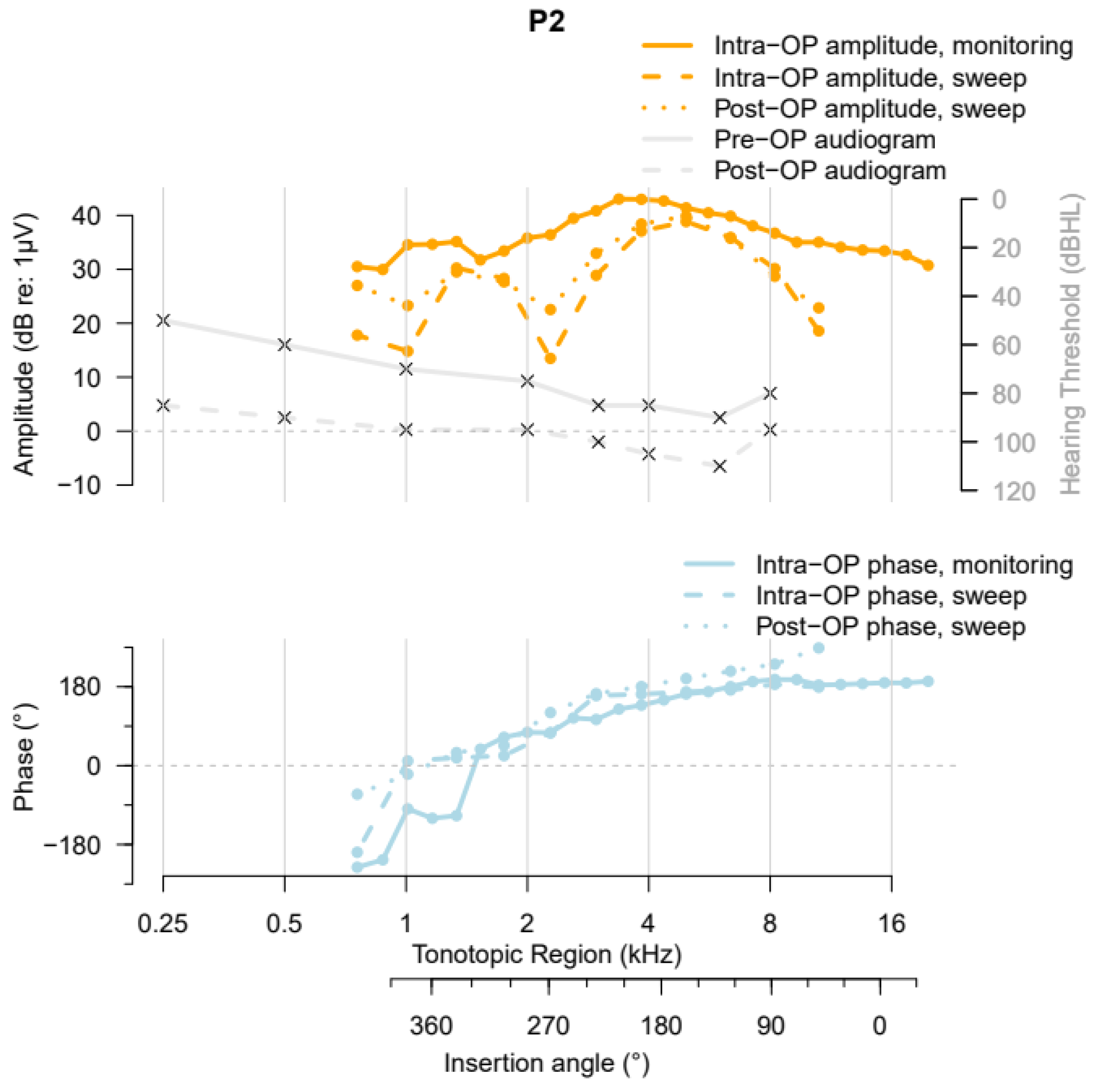 ZH-ECochG Bode Plot: A Novel Approach to Visualize ...