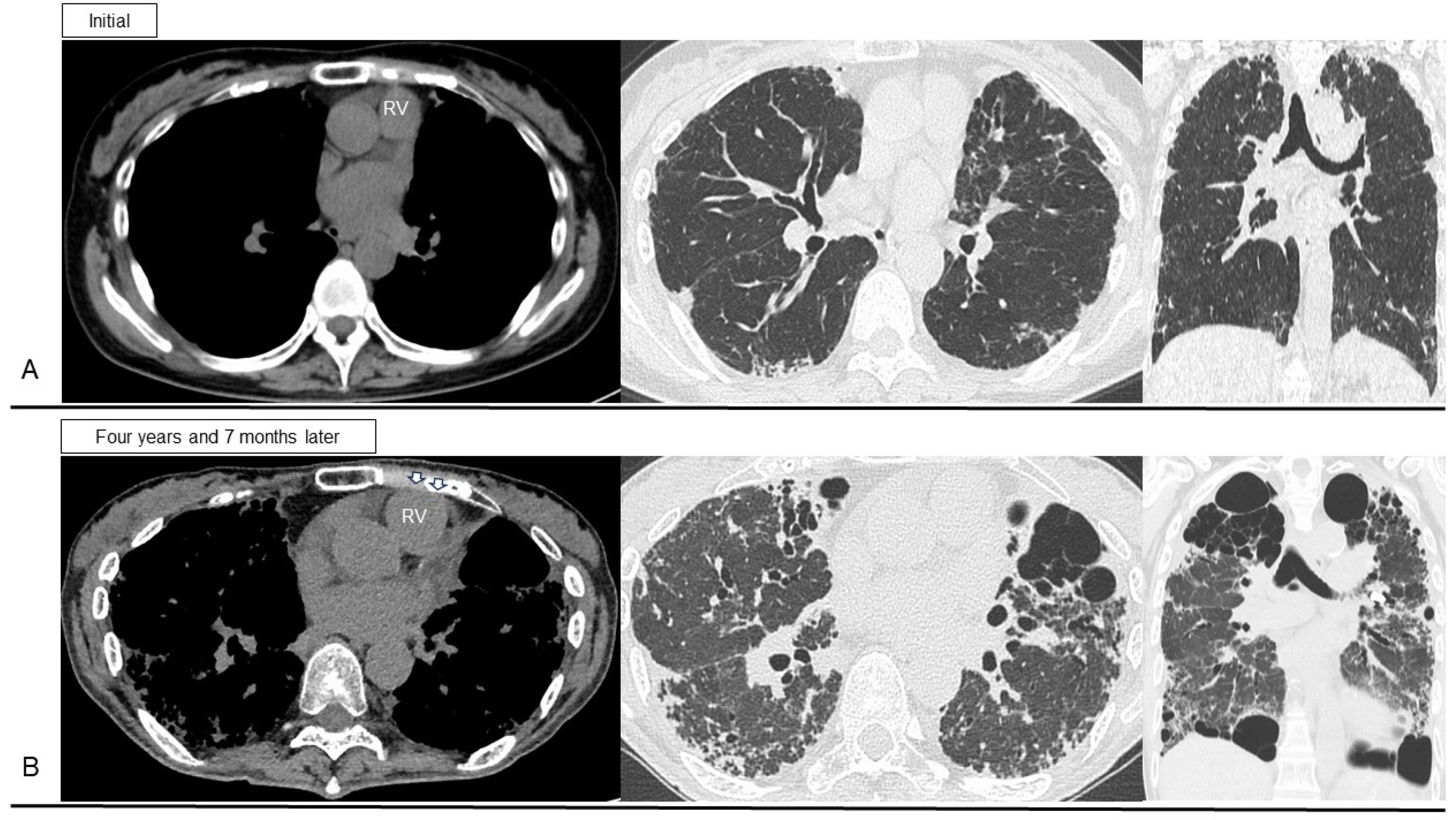 JCM | Free Full-Text | Proposed Clinical Algorithm for ...