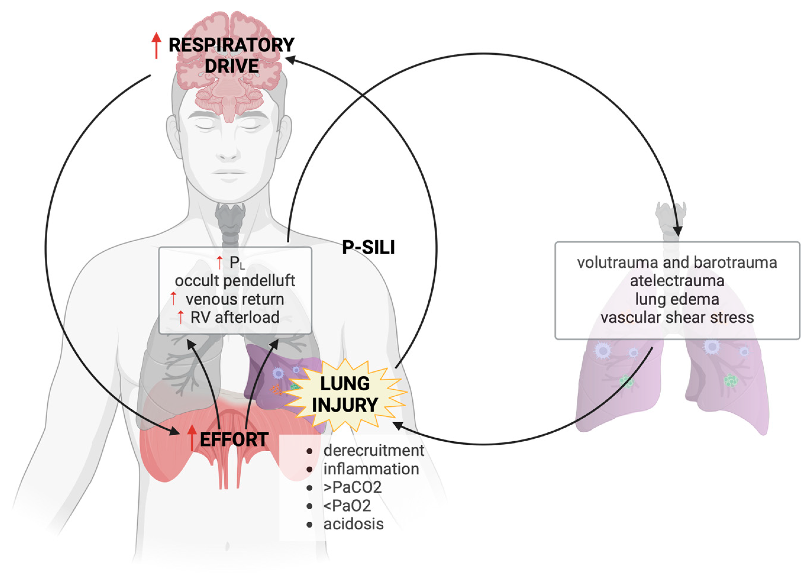 Clinical And Experimental Evidence For Patient Self Inflicted Lung Clinical And Experimental Evidence For Patient Self Inflicted Lung