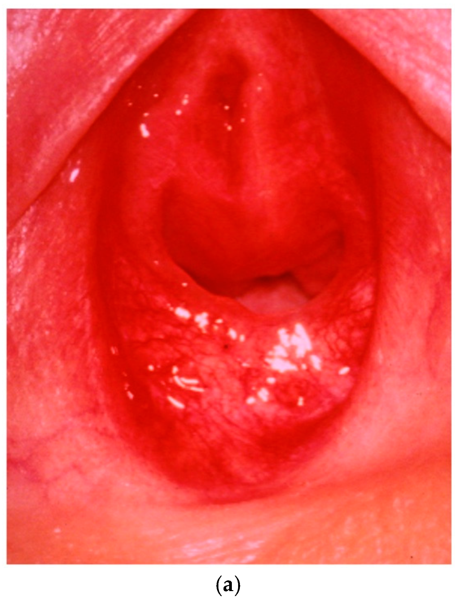 child hymen exam Understanding Medical Findings in Child Sexual Abuse: An Update For 2018 -  Joyce A. Adams, 2018