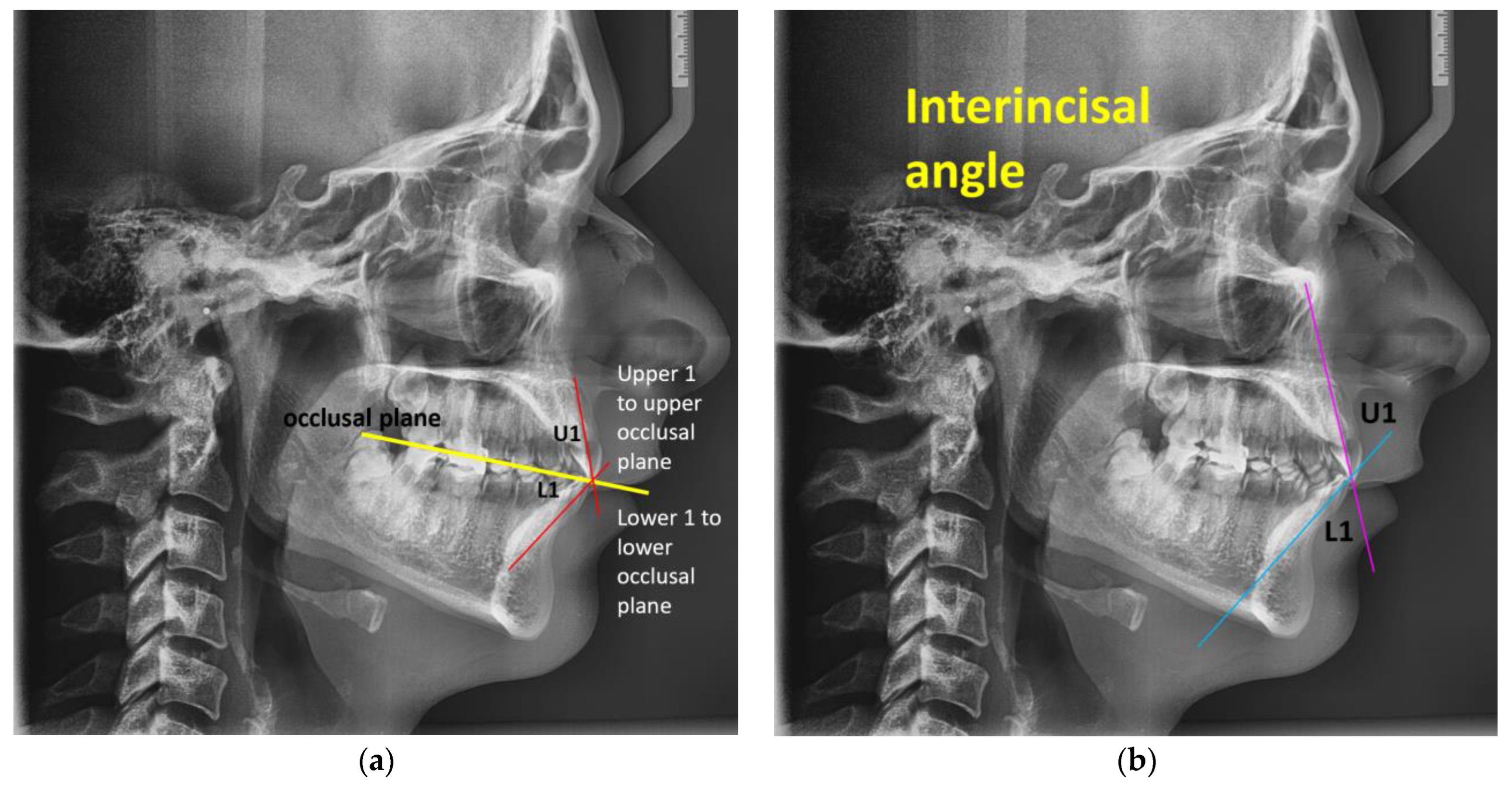 Innovative Aesthetic and Functional Orthodontic Planning with Hard and Innovative Aesthetic and Functional Orthodontic Planning with Hard and