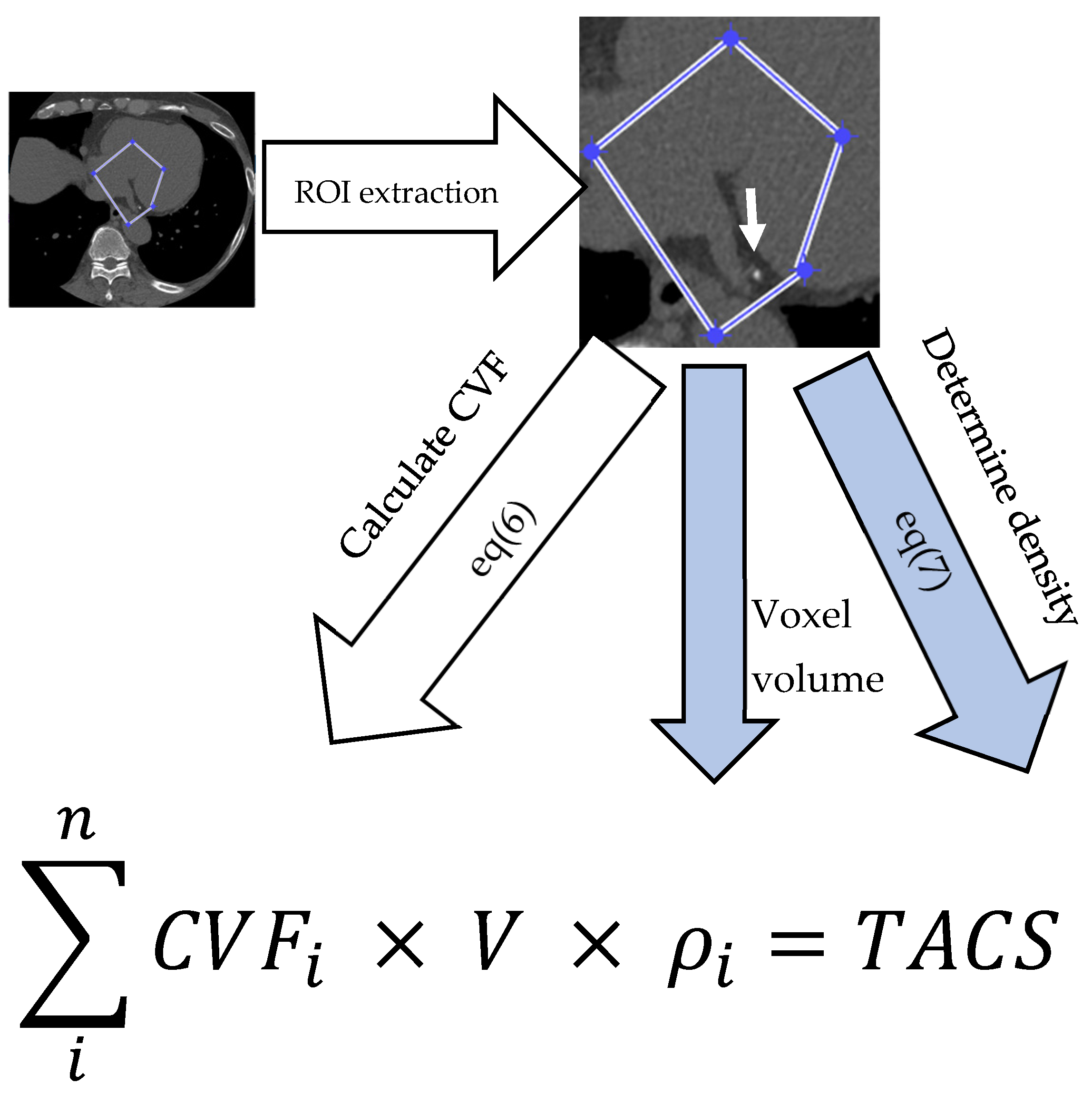 Application of the Novel Two-Compartmental Model to Quantify Coronary ...