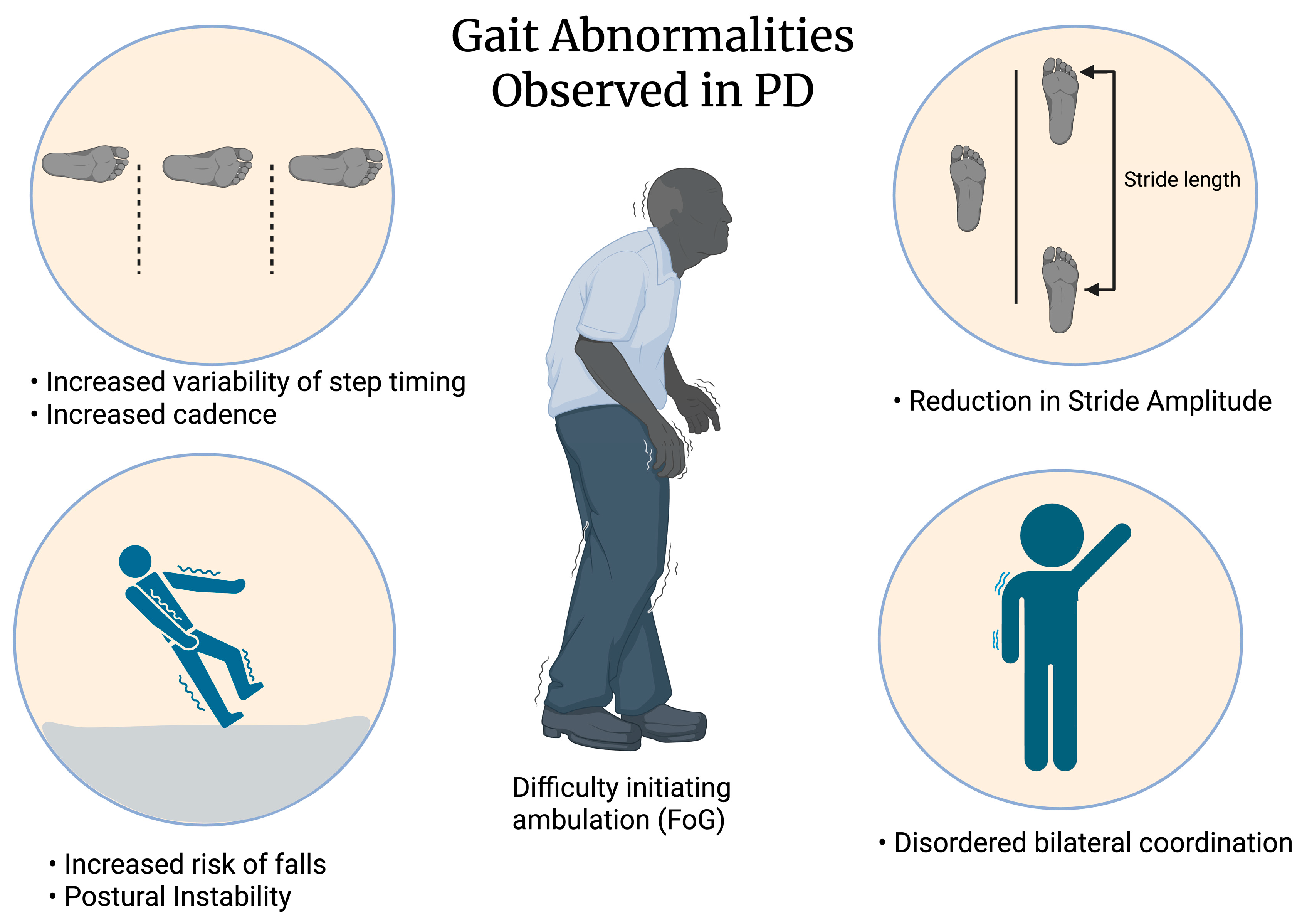 Use of AR/VR for Treatment of Freezing of Gait (FoG) in Parkinson’s ...