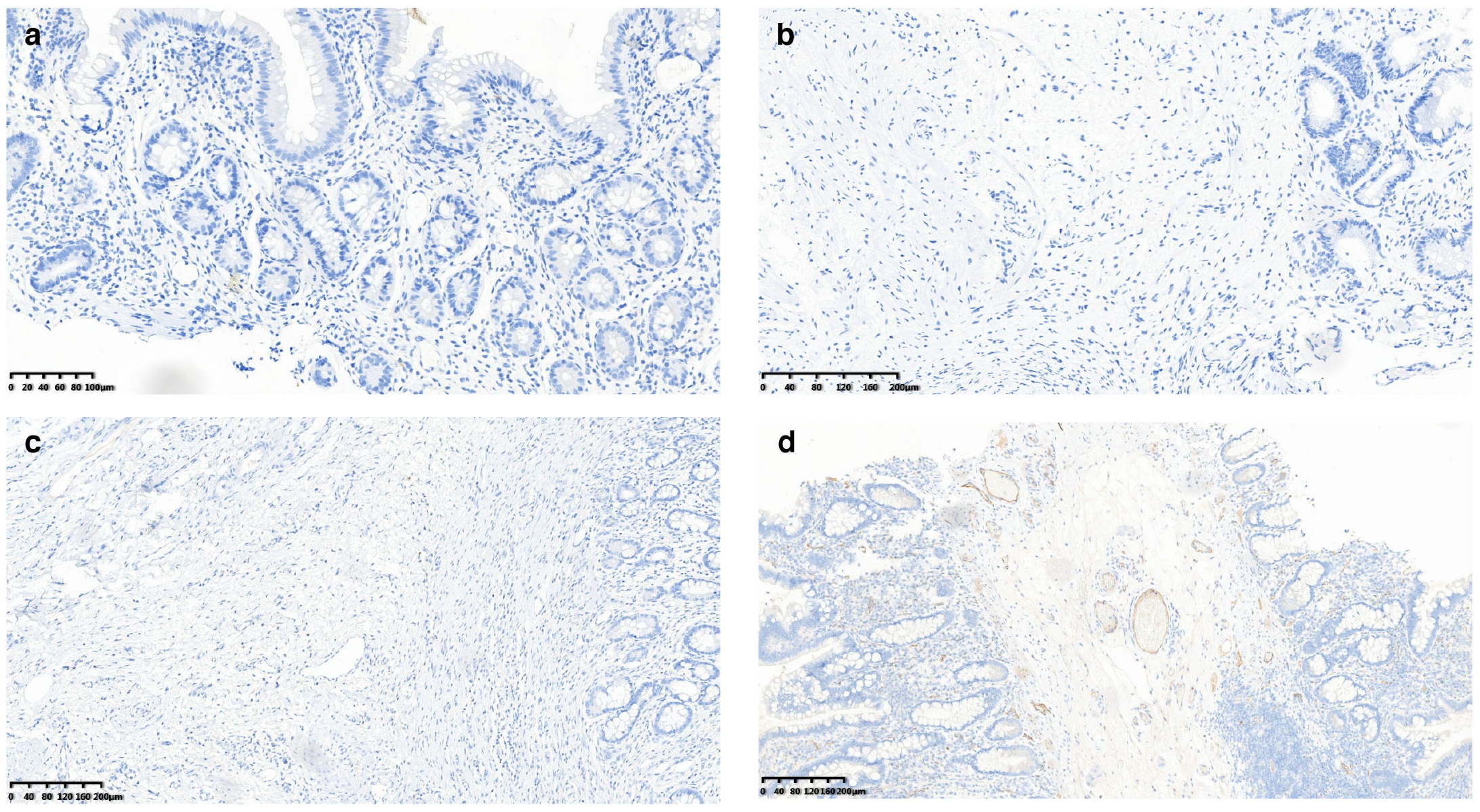 Is There a Reliable, Rapid, and Economic Diagnostic Approach for ...