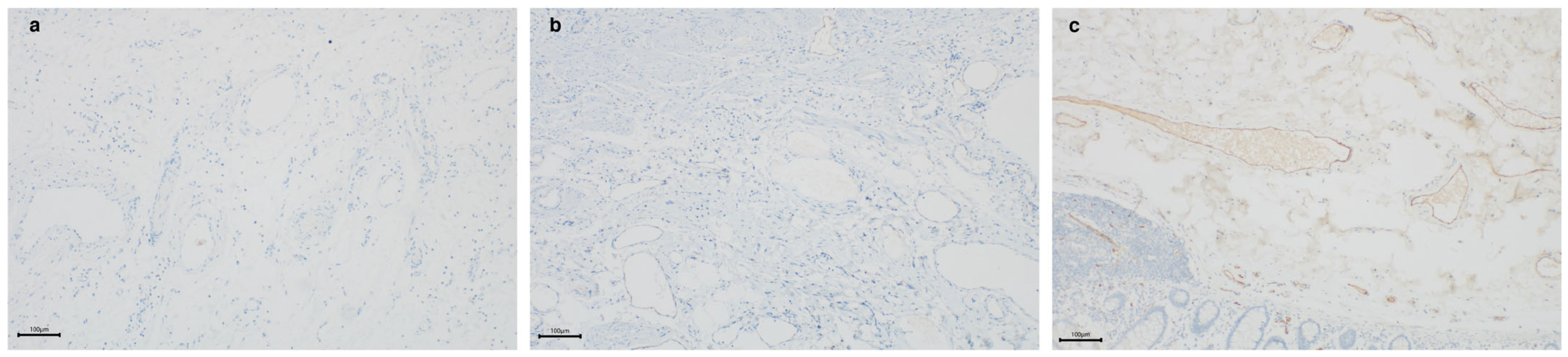 Is There a Reliable, Rapid, and Economic Diagnostic Approach for ...