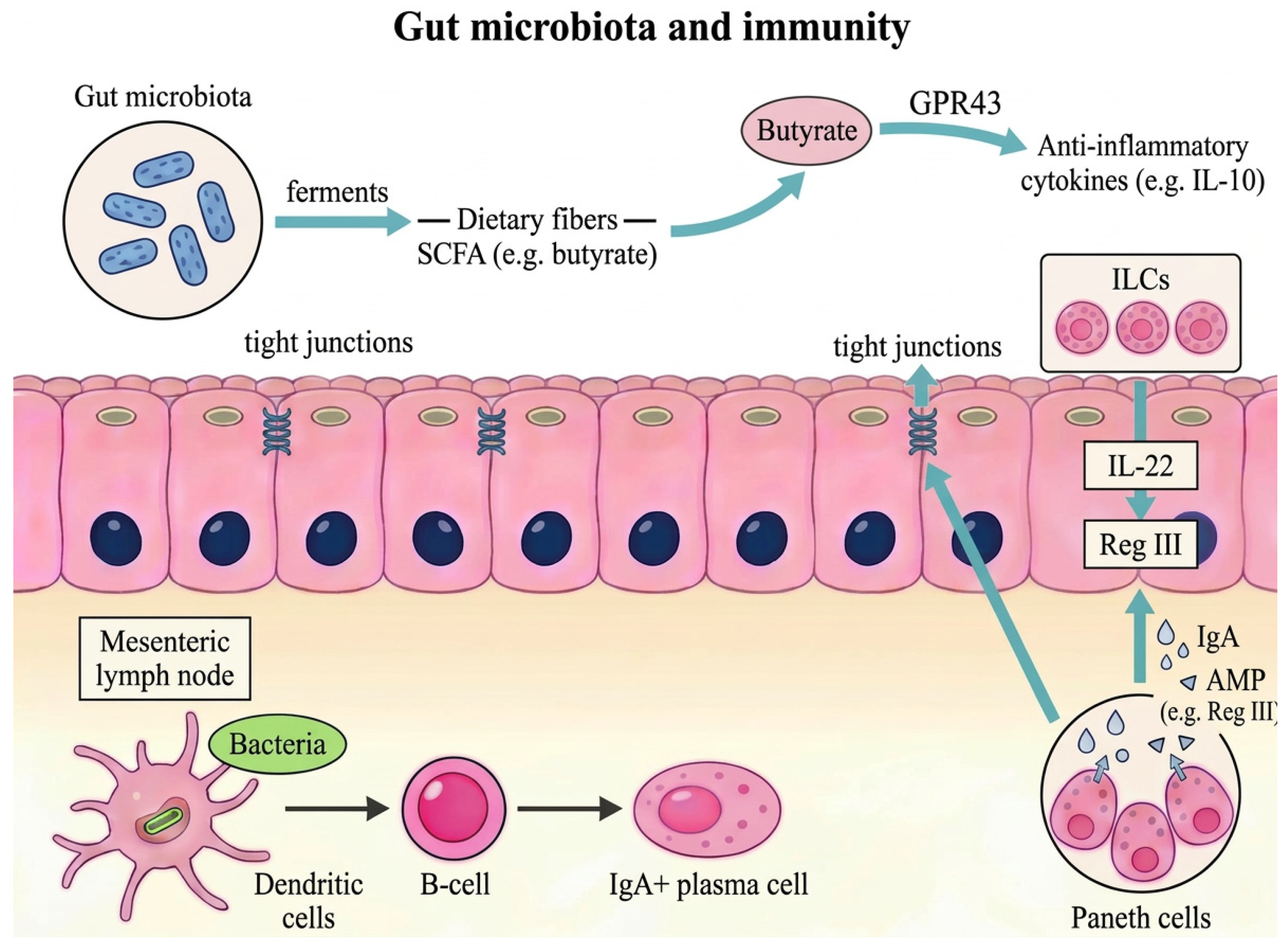 The Role of Gut Microbiota in Acute Myeloid Leukemia