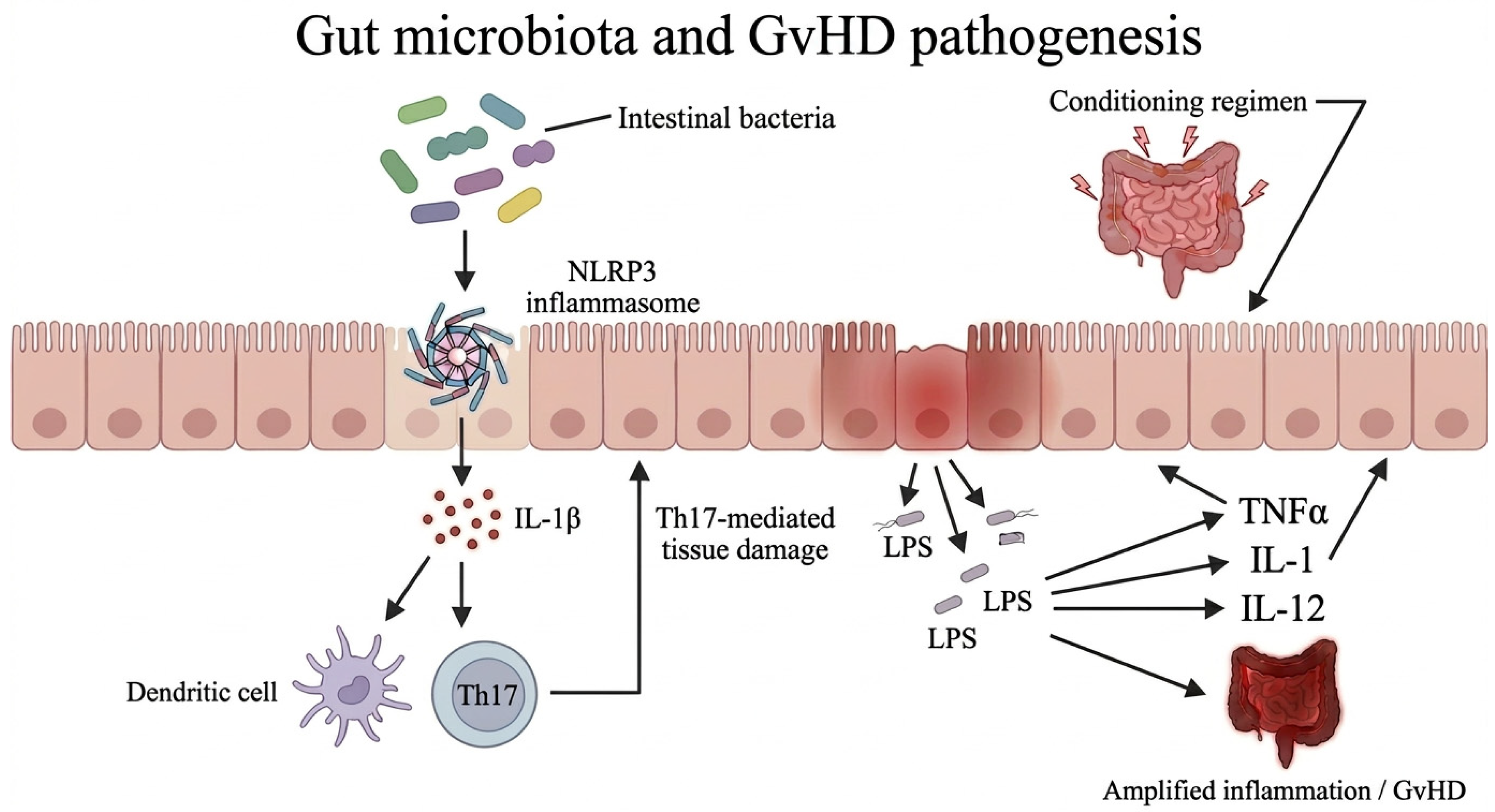 The Role of Gut Microbiota in Acute Myeloid Leukemia