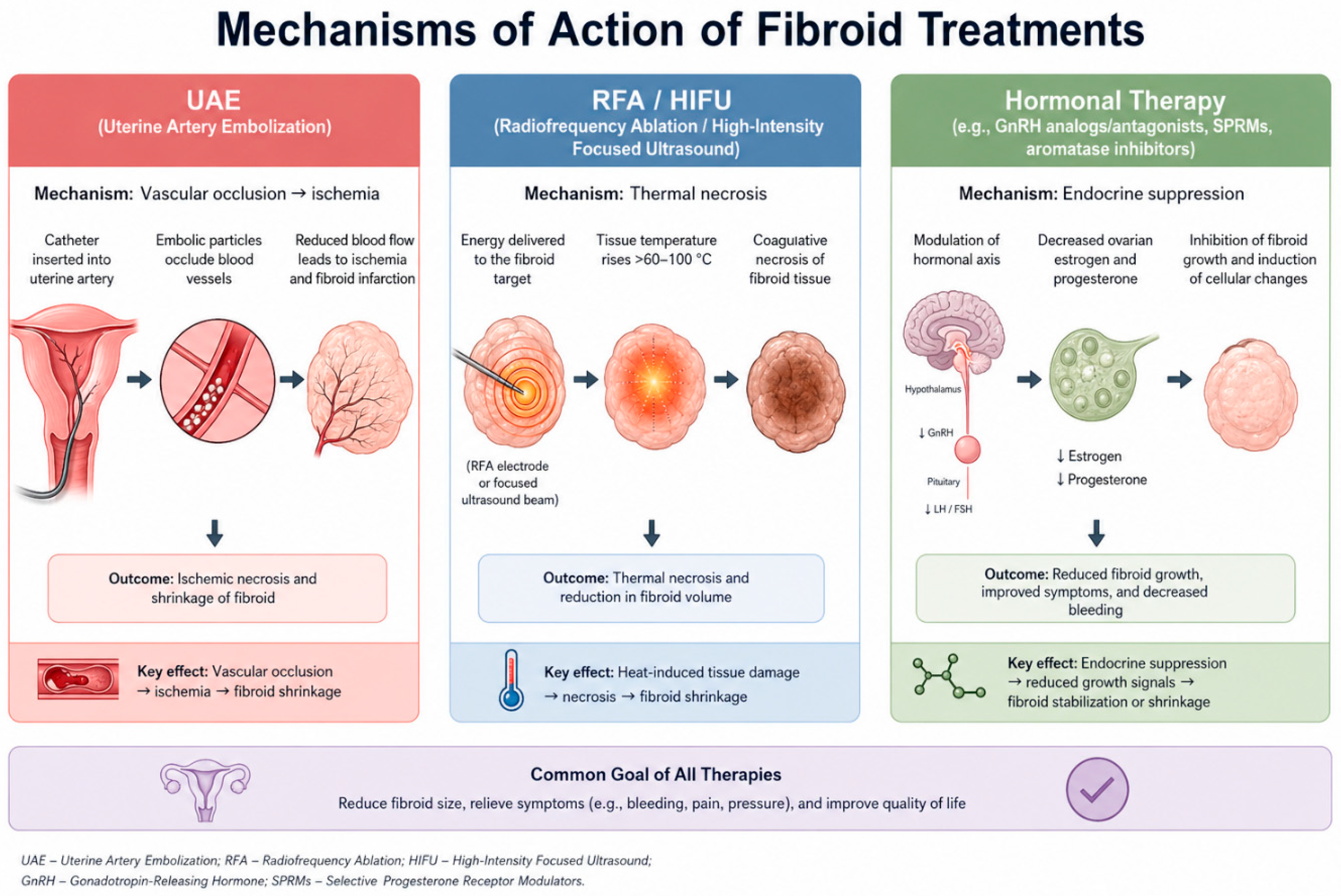 Contemporary Management of Uterine Fibroids
