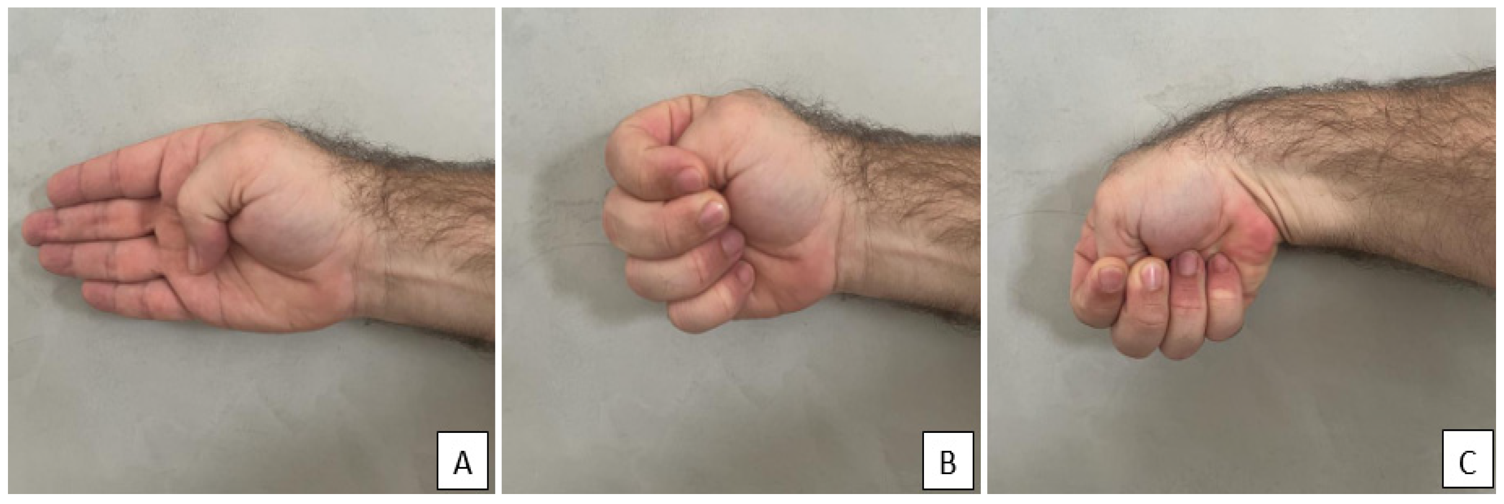 Prevalence and Risk Factors for Musculoskeletal Disorders in Medical ...
