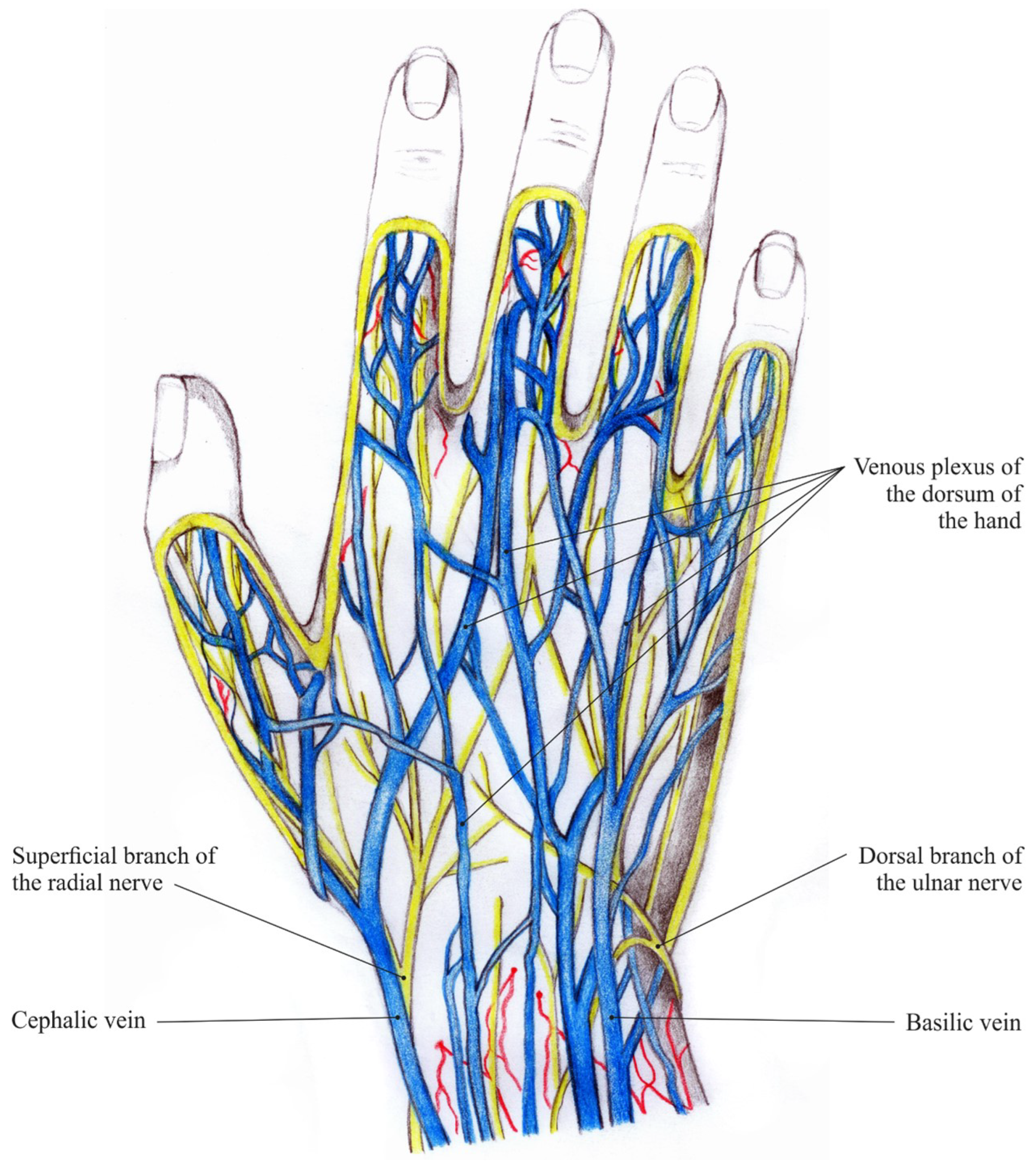Ulnar artery distal cutaneous descending branch as free flap in hand  reconstruction - ScienceDirect