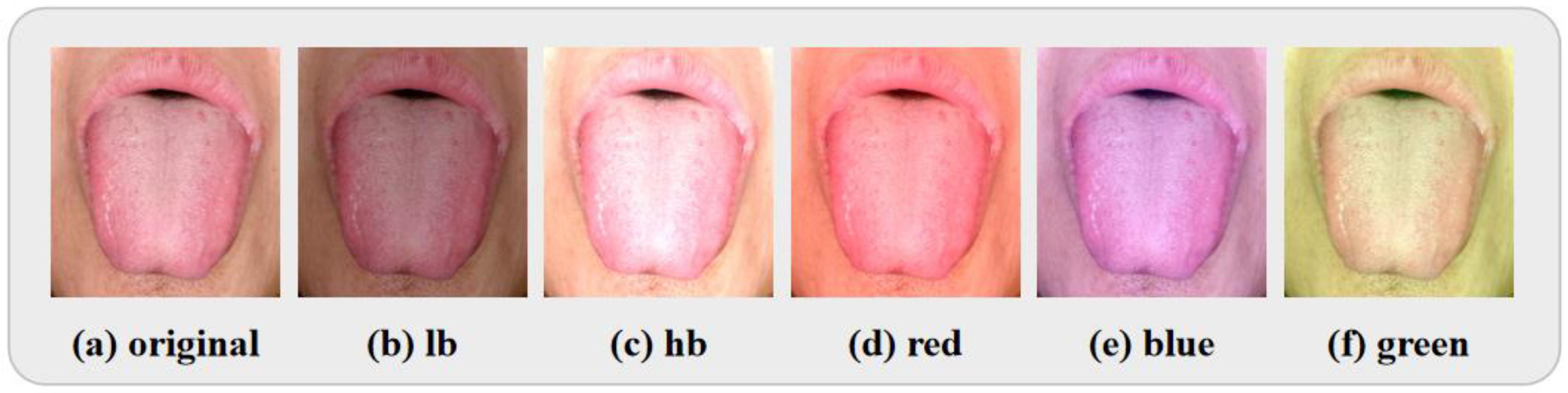 A Deep Regression Model for Tongue Image Color Correction Based on CNN