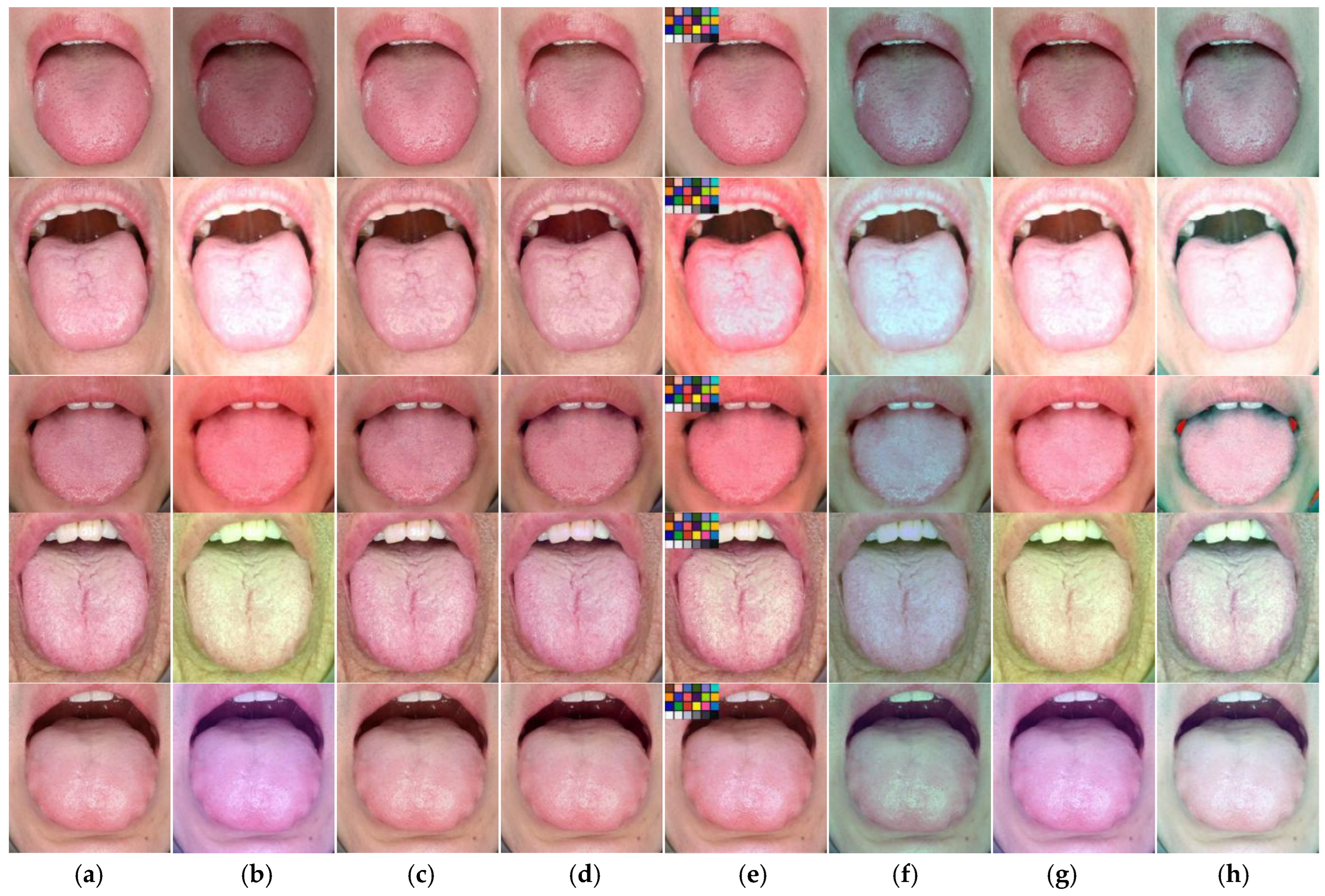 A Deep Regression Model for Tongue Image Color Correction Based on CNN