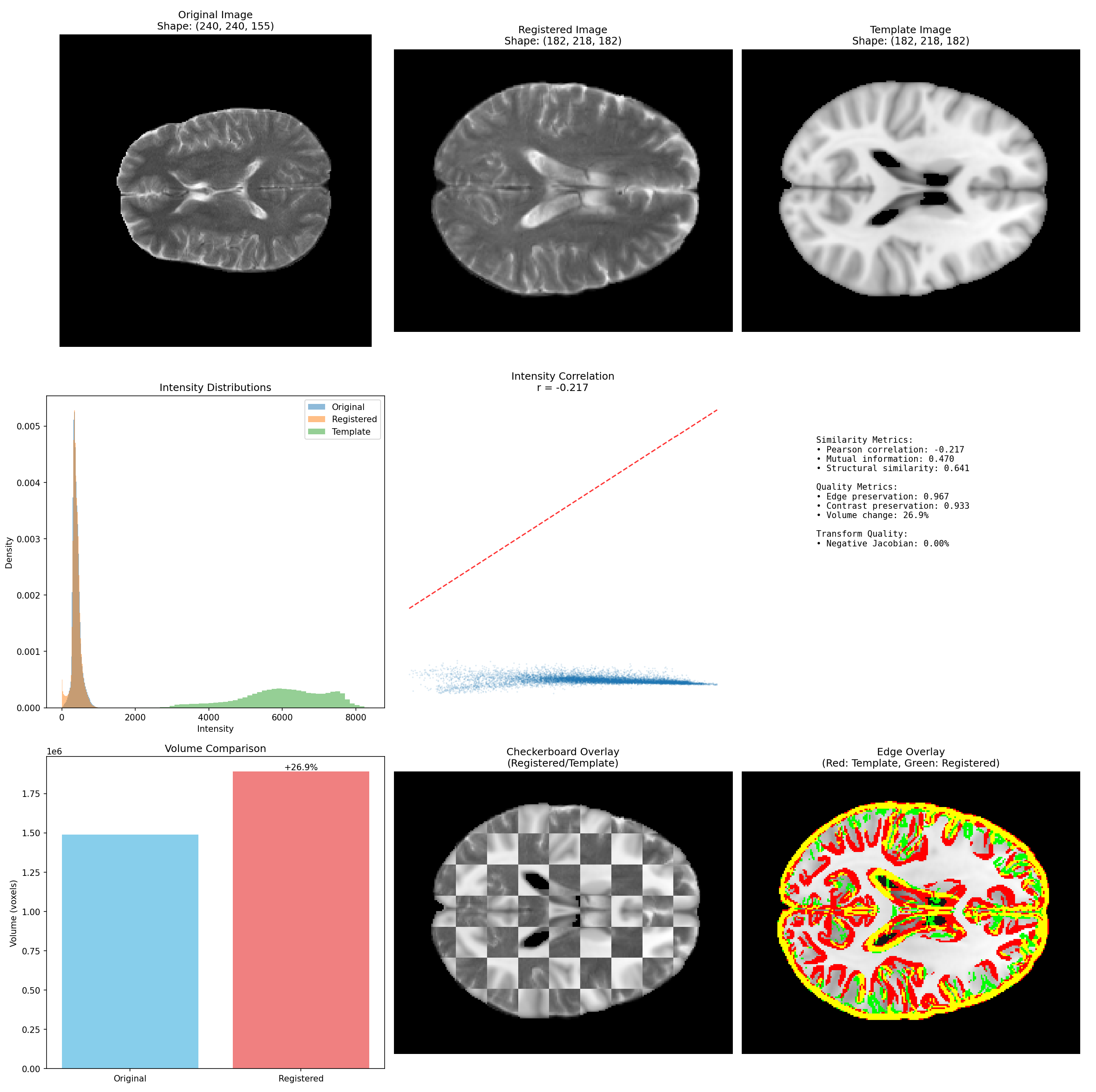 A Structured Review and Quantitative Profiling of Public Brain MRI ...