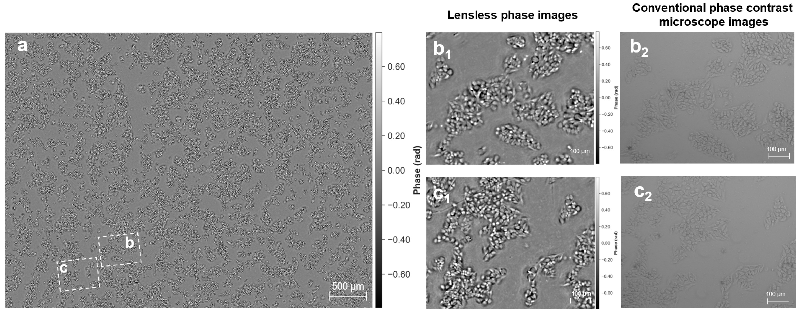 Lensless Quantitative Phase Imaging with Bayer-Filtered Color Sensors ...