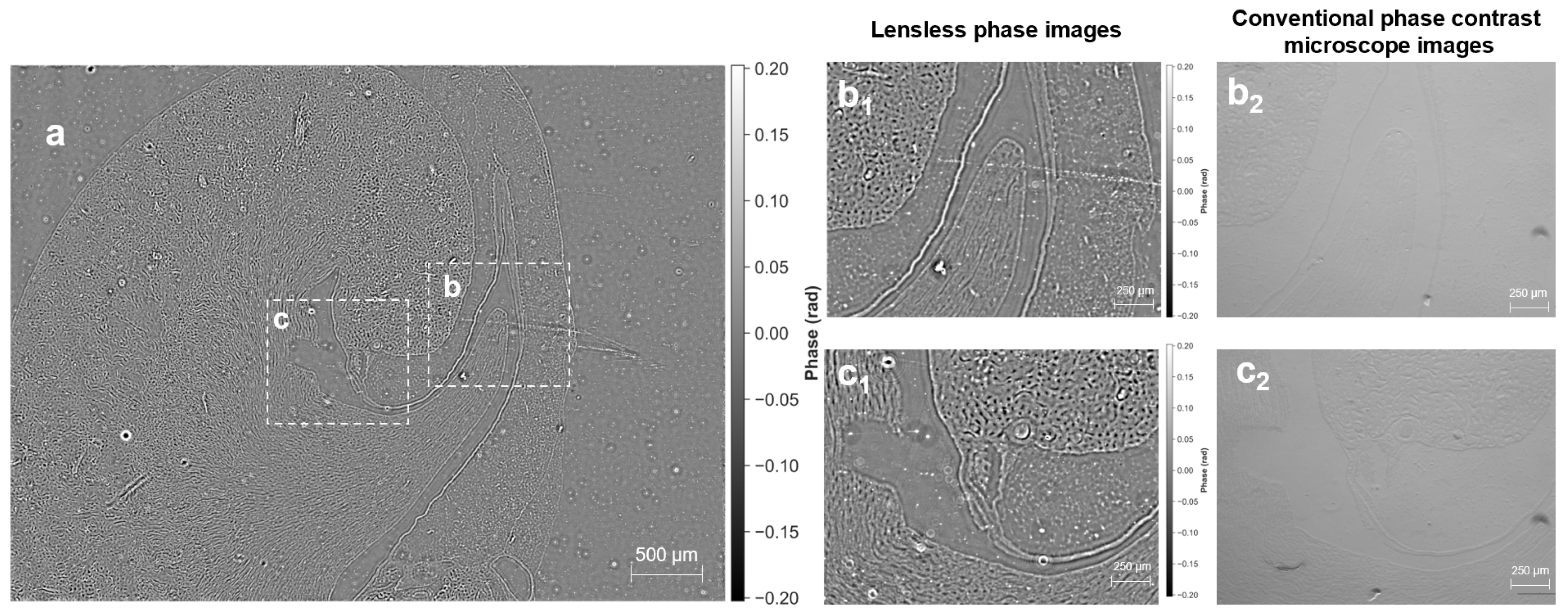 Lensless Quantitative Phase Imaging with Bayer-Filtered Color Sensors ...