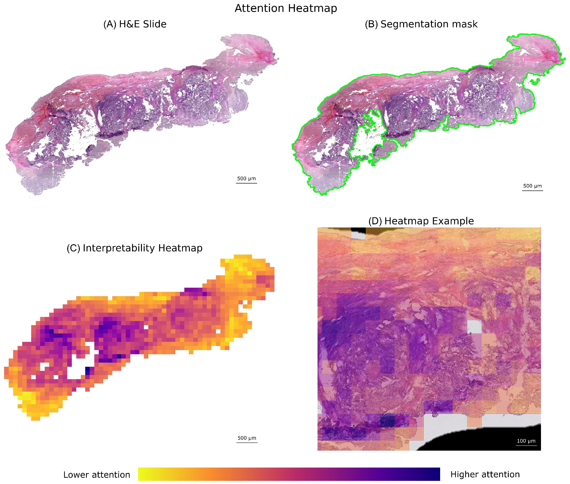 Development and Evaluation of a Deep Learning Model for Ovarian Cancer ...