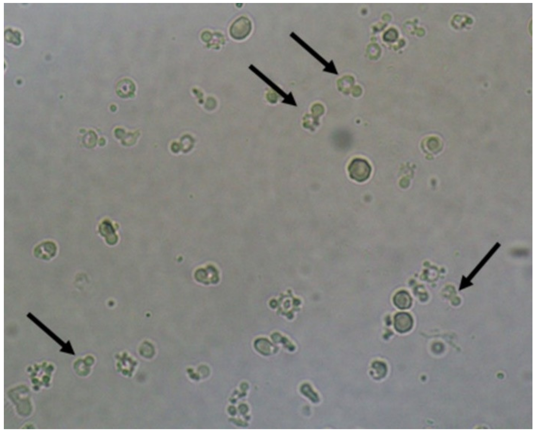 Jof Free Full Text Urine Sediment Findings And The Immune Response To Pathologies In Fungal 9712