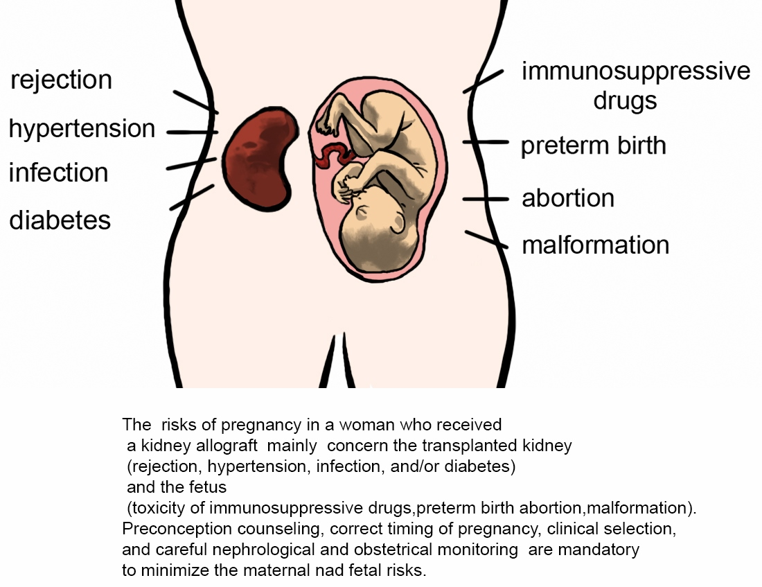 JPM | Free Full-Text | Planned Pregnancy in Kidney Transplantation
