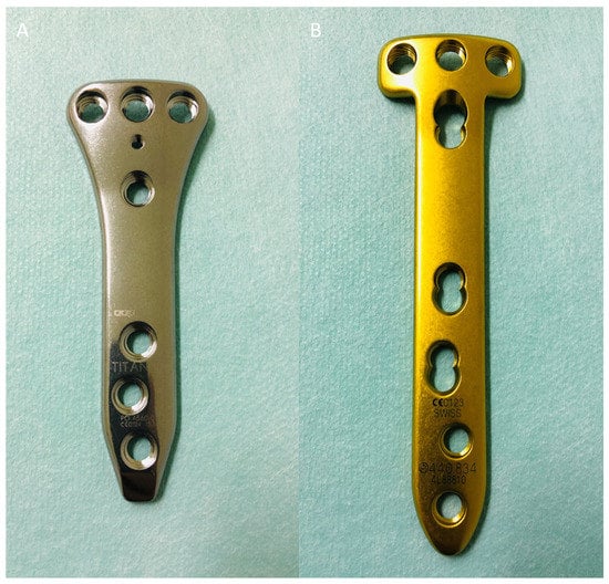 Clinical Outcome after Medial Open-Wedge High Tibial