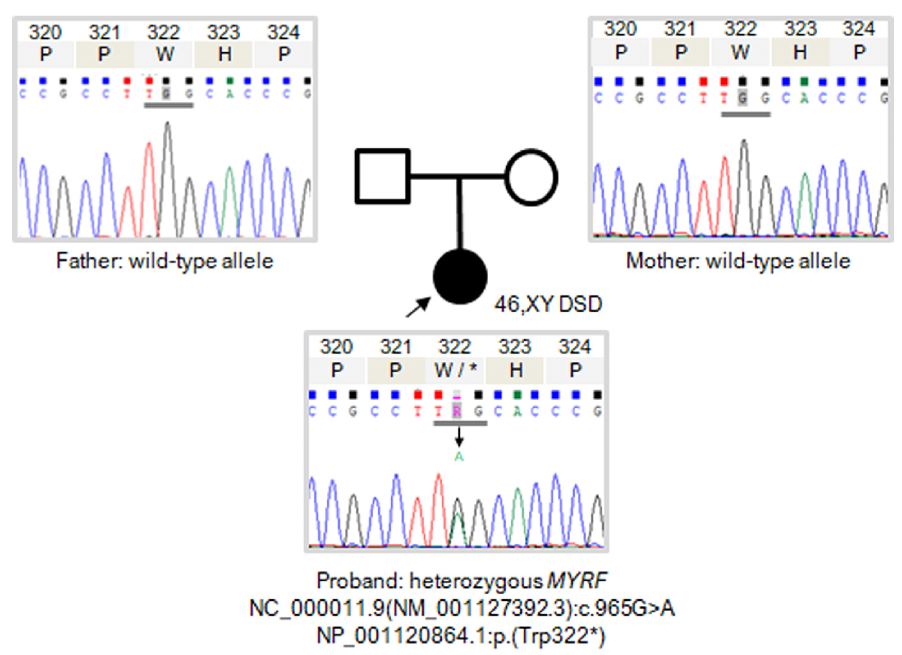 Identification Of A Novel Variant In Myelin Regulatory Growth Factor By