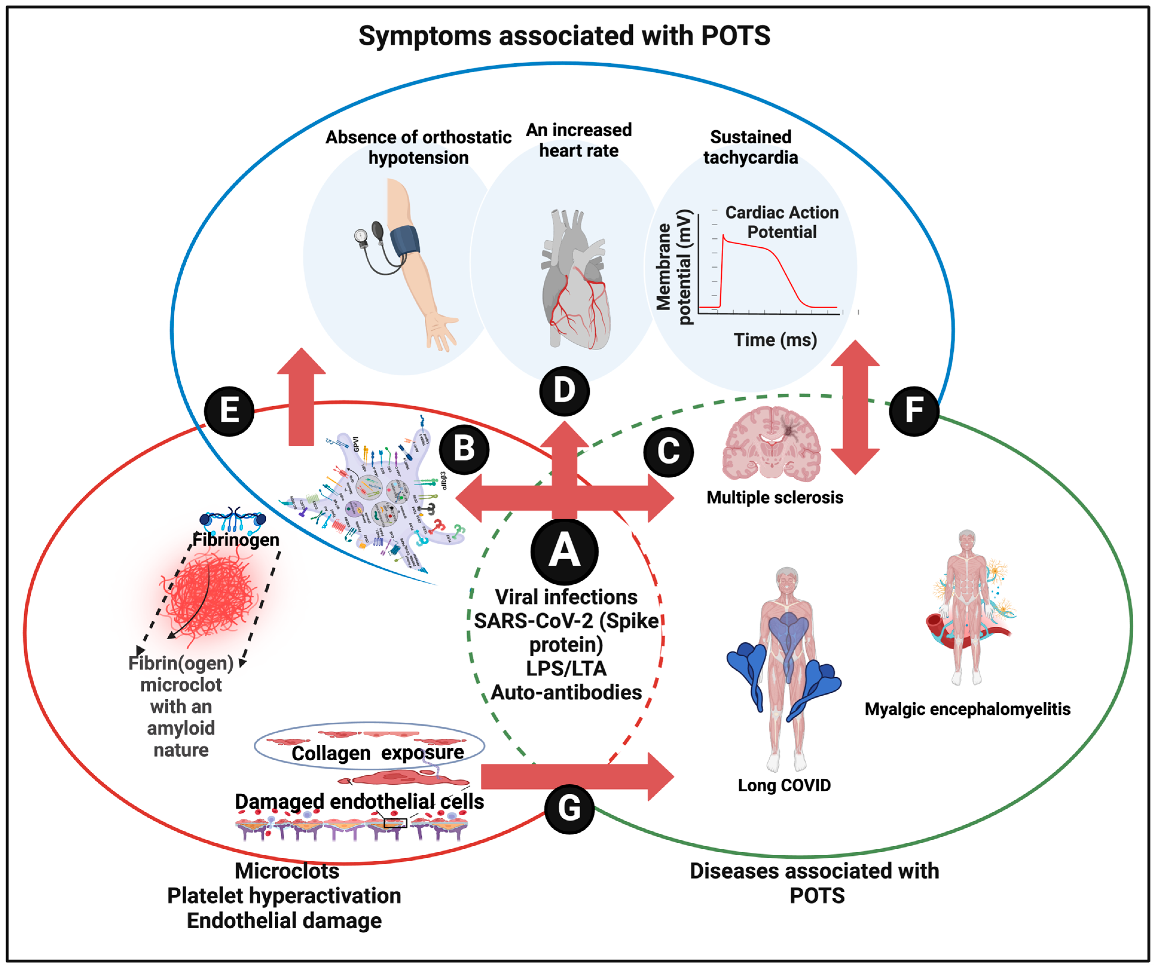 PDF] Postural Orthostatic Tachycardia Syndrome (POTS) – A novel member of  the autoimmune family