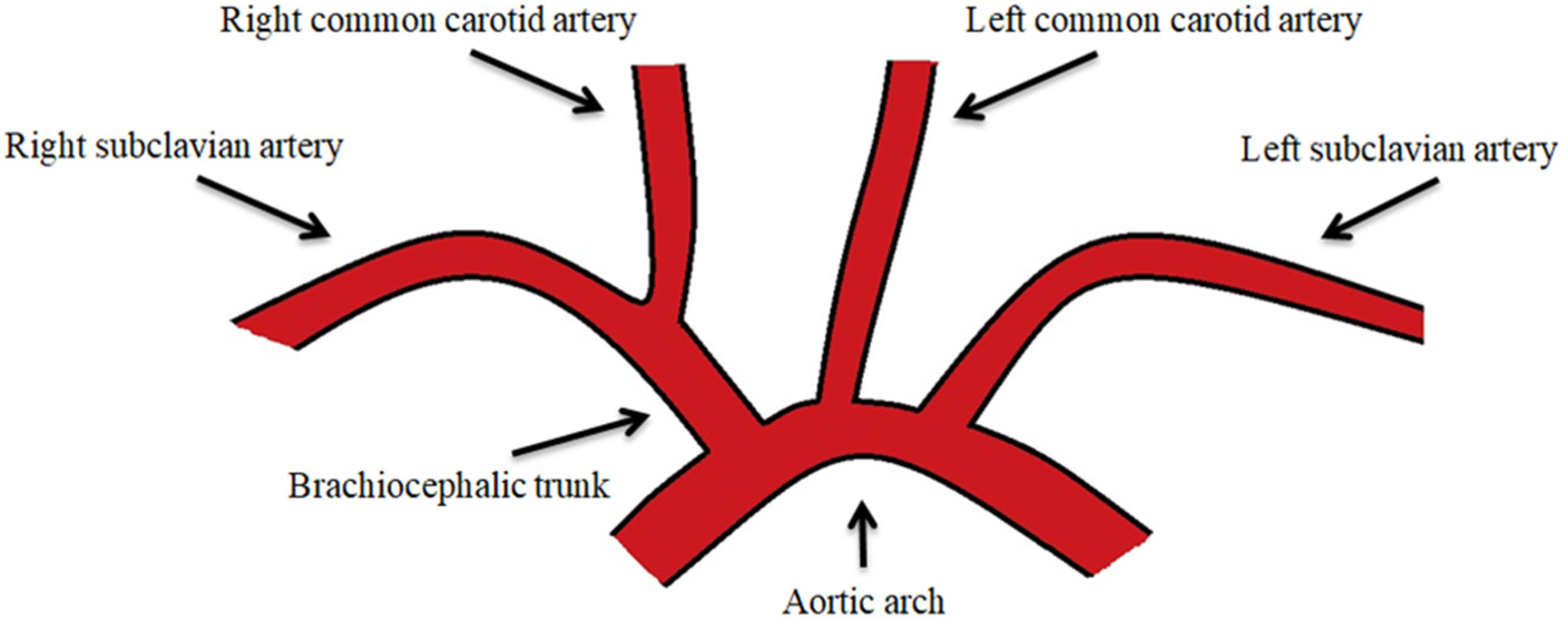 JPM | Free Full-Text | Medical–Surgical Implications of Branching ...