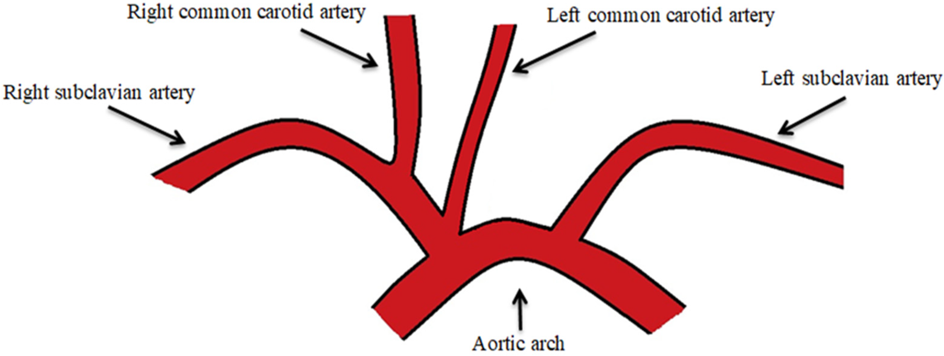 JPM | Free Full-Text | Medical–Surgical Implications of Branching ...