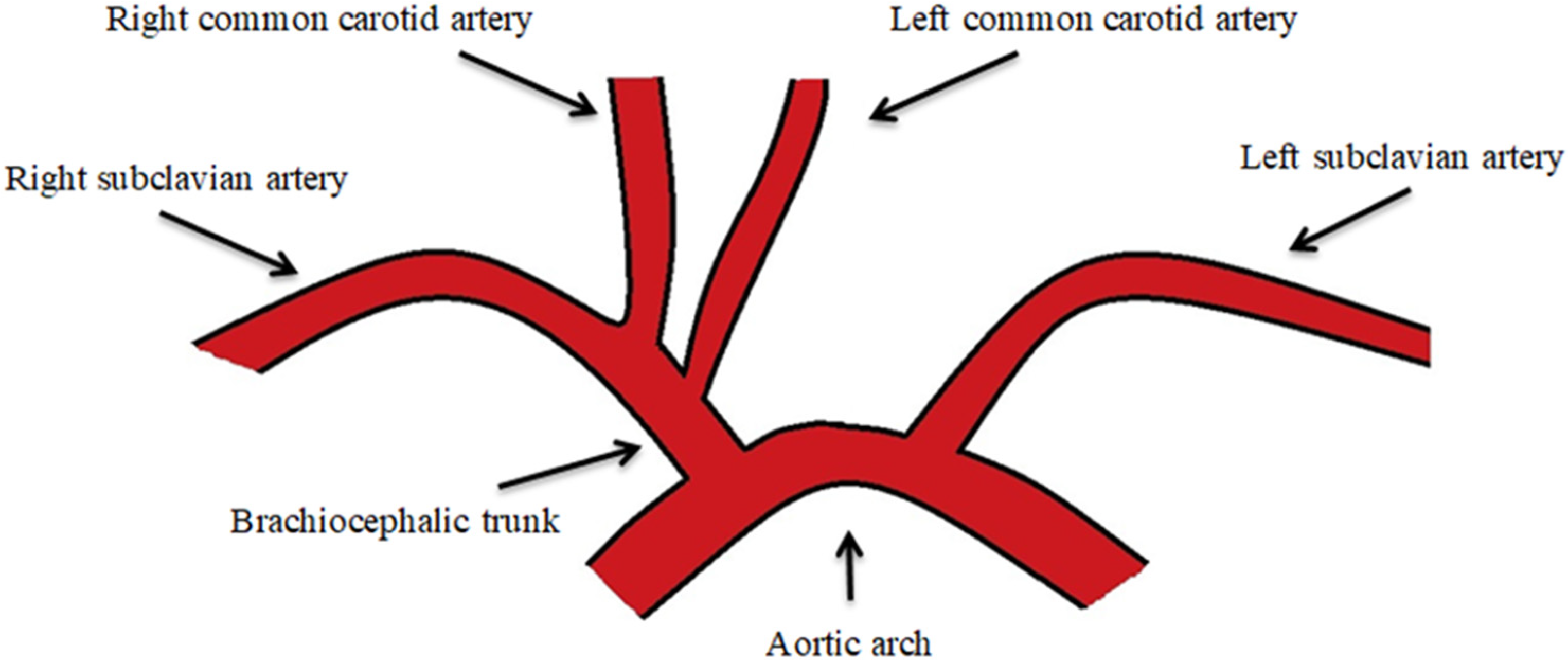 JPM | Free Full-Text | Medical–Surgical Implications of Branching ...