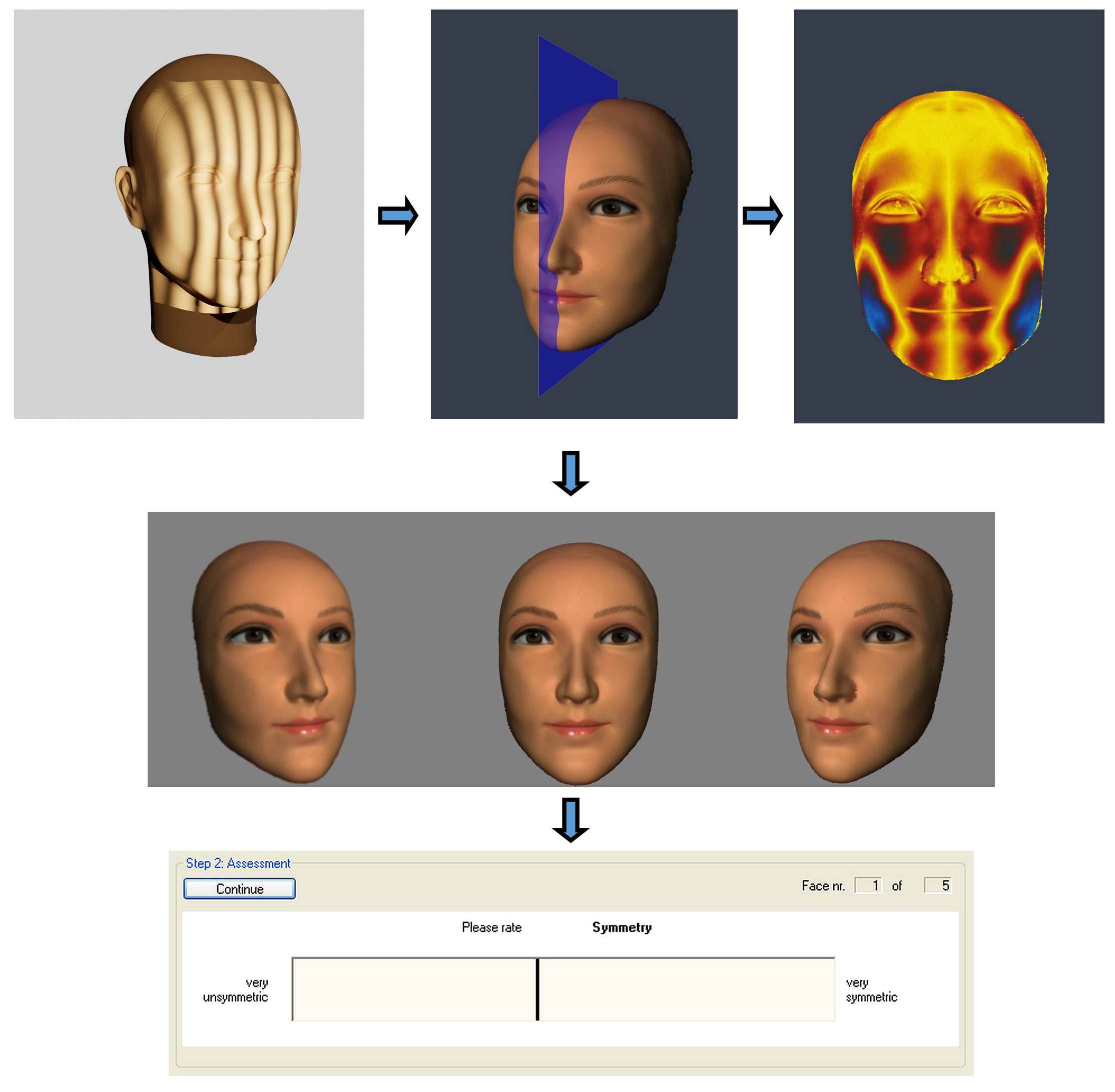 Limits In The Perception Of Facial Symmetry A Prospective Study Limits In The Perception Of Facial Symmetry A Prospective Study