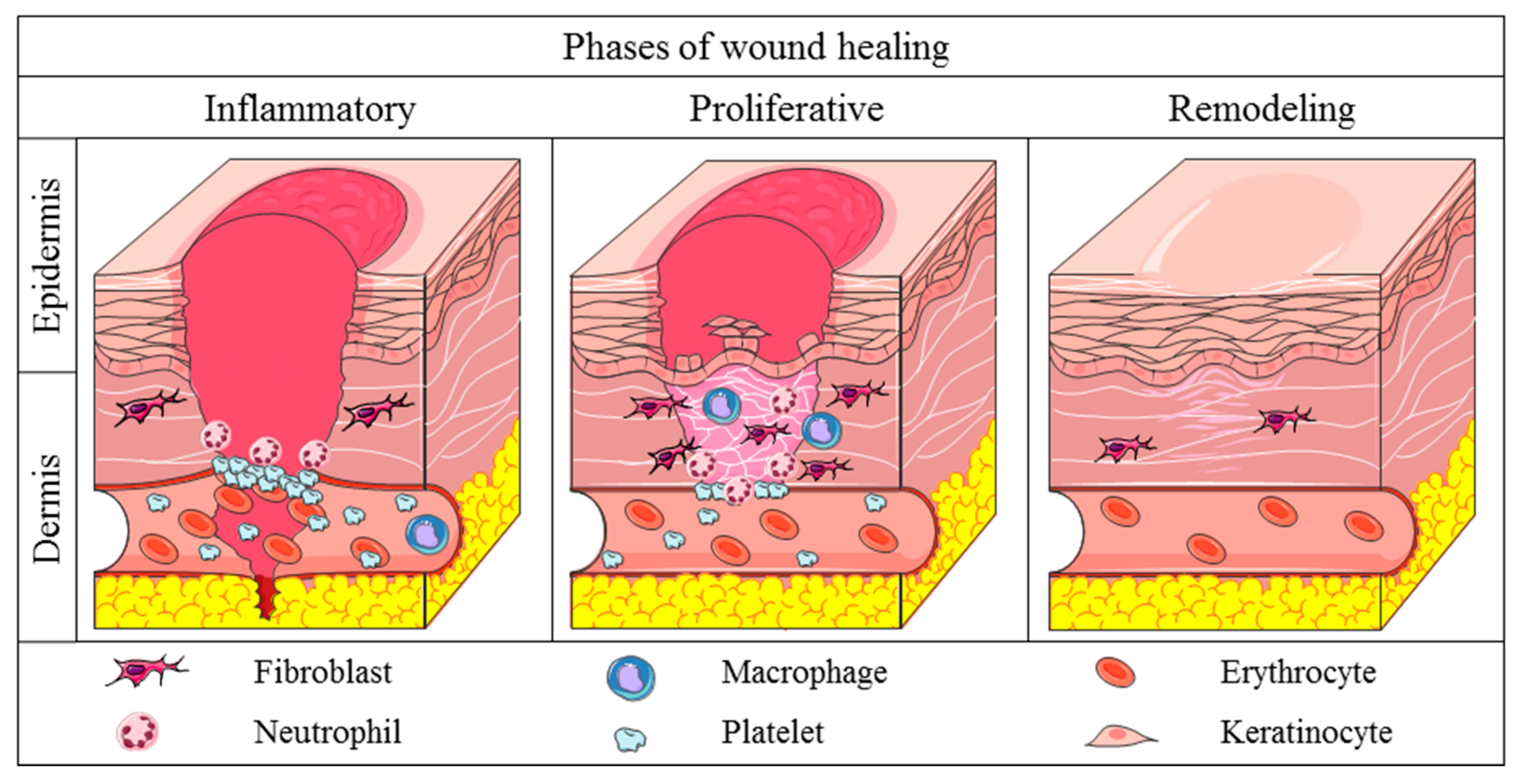 Life | Free Full-Text | Cutaneous Wound Healing: An Update from  Physiopathology to Current Therapies