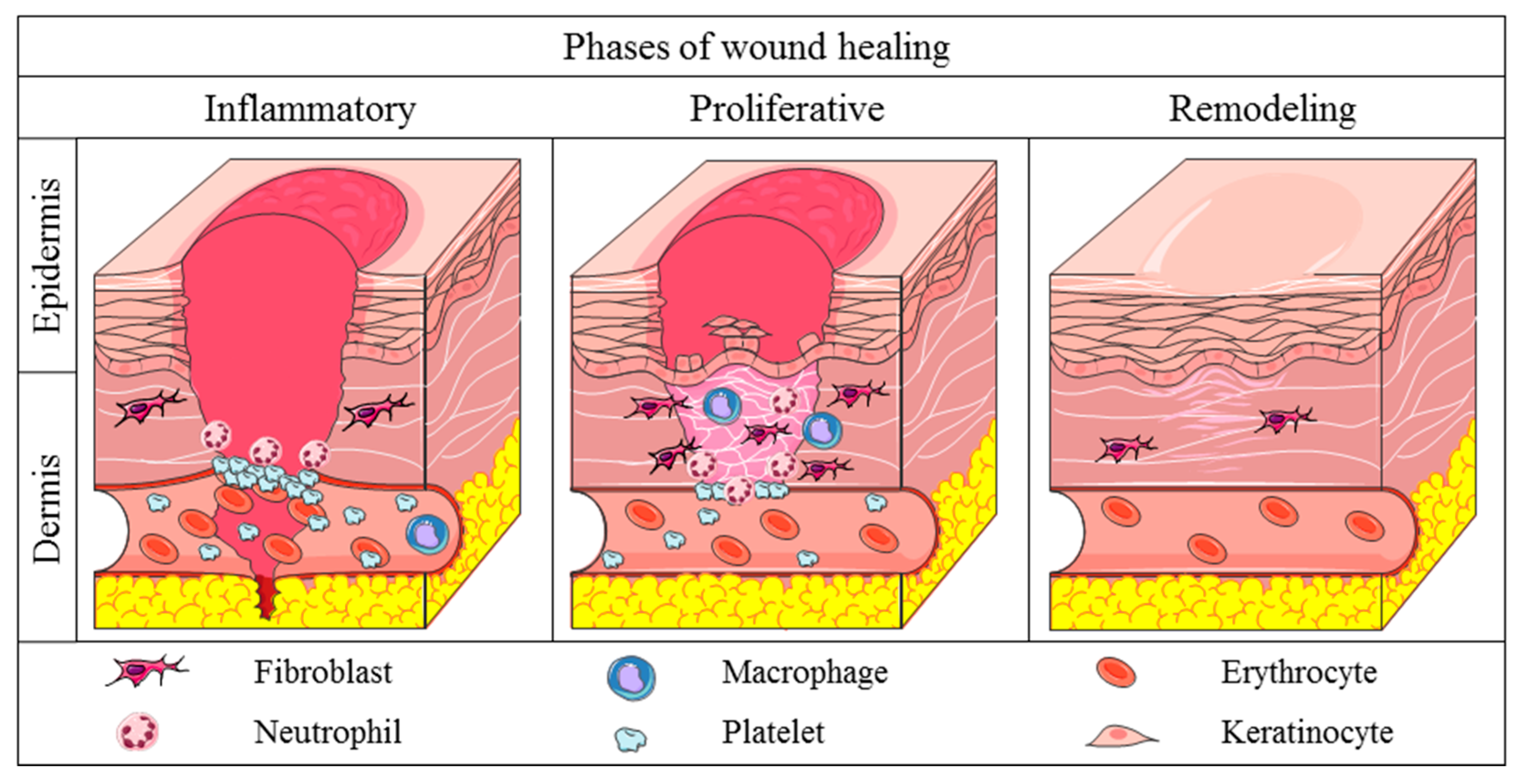 Life | Free Full-Text | Cutaneous Wound Healing: An Update from Physiopathology to Current Therapies