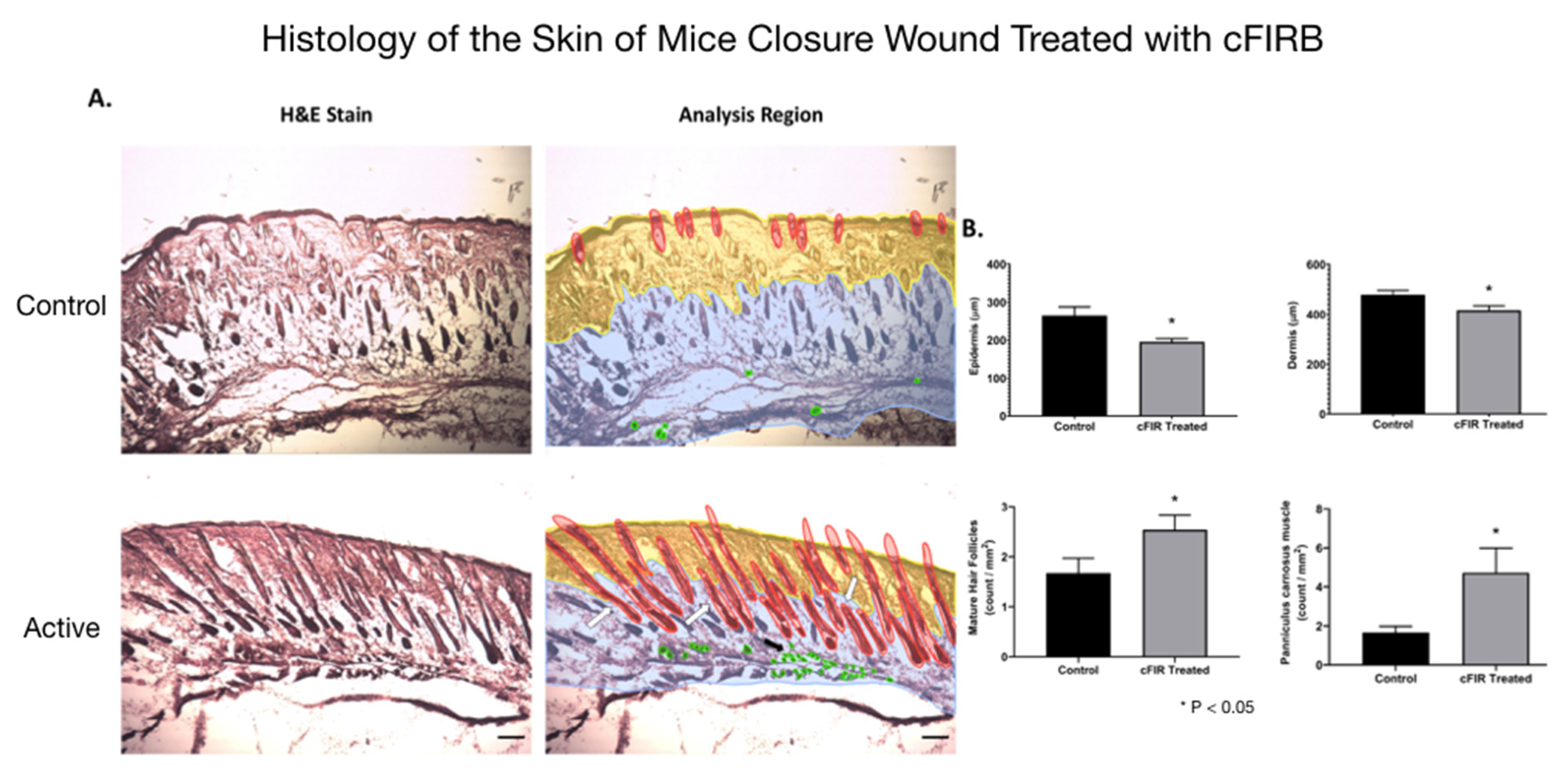 Far-Infrared Therapy Helps Wounds Heal Faster
