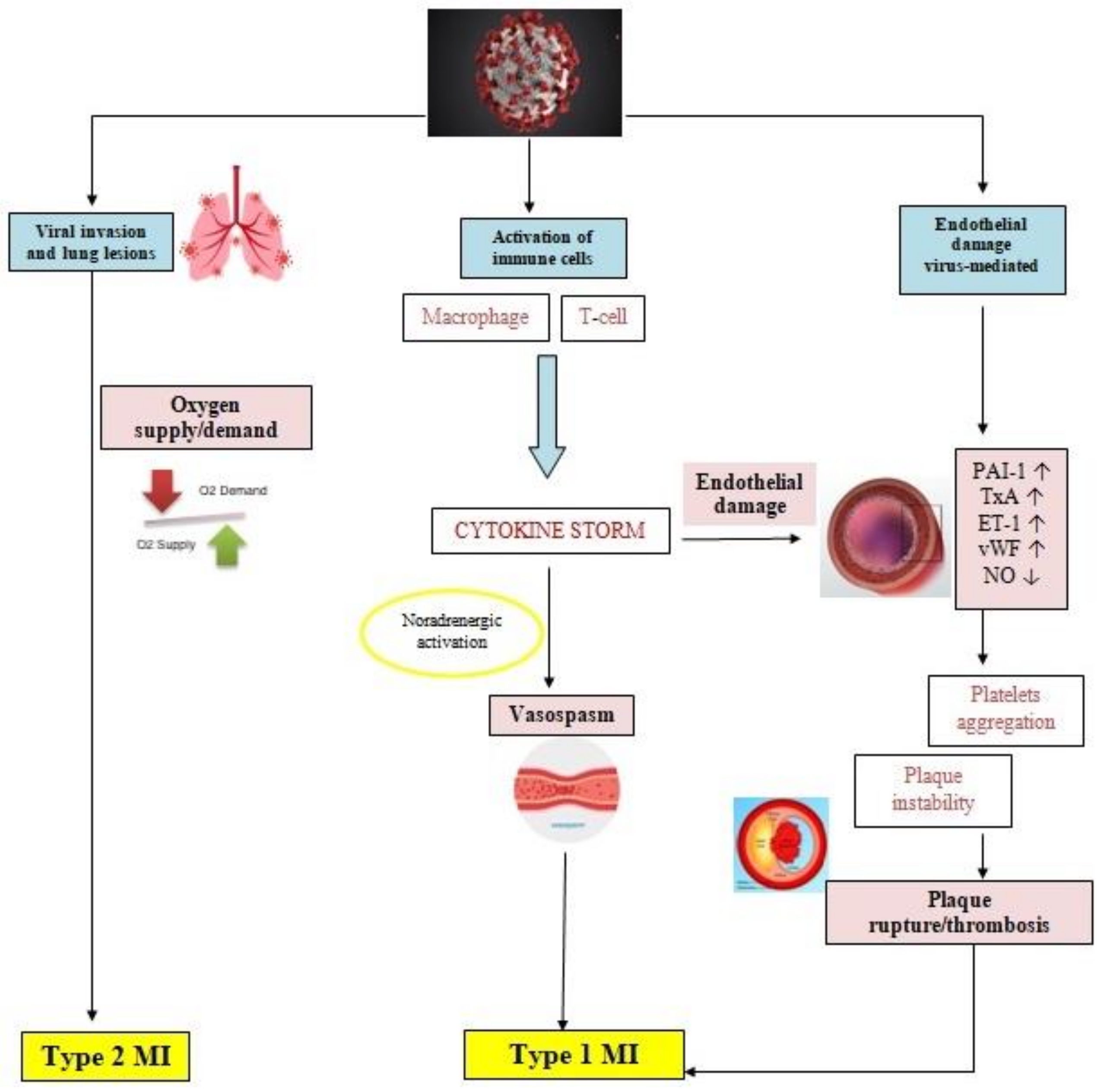 Life Free Full-Text Myocardial Ischemia in Patients with COVID-19 Infection Between Pathophysiological Mechanisms and Electrocardiographic Findings