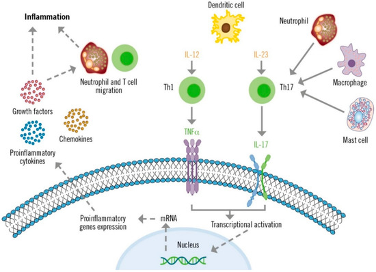The Essential Role of IL-17 as the Pathogenetic Link between Psoriasis ...
