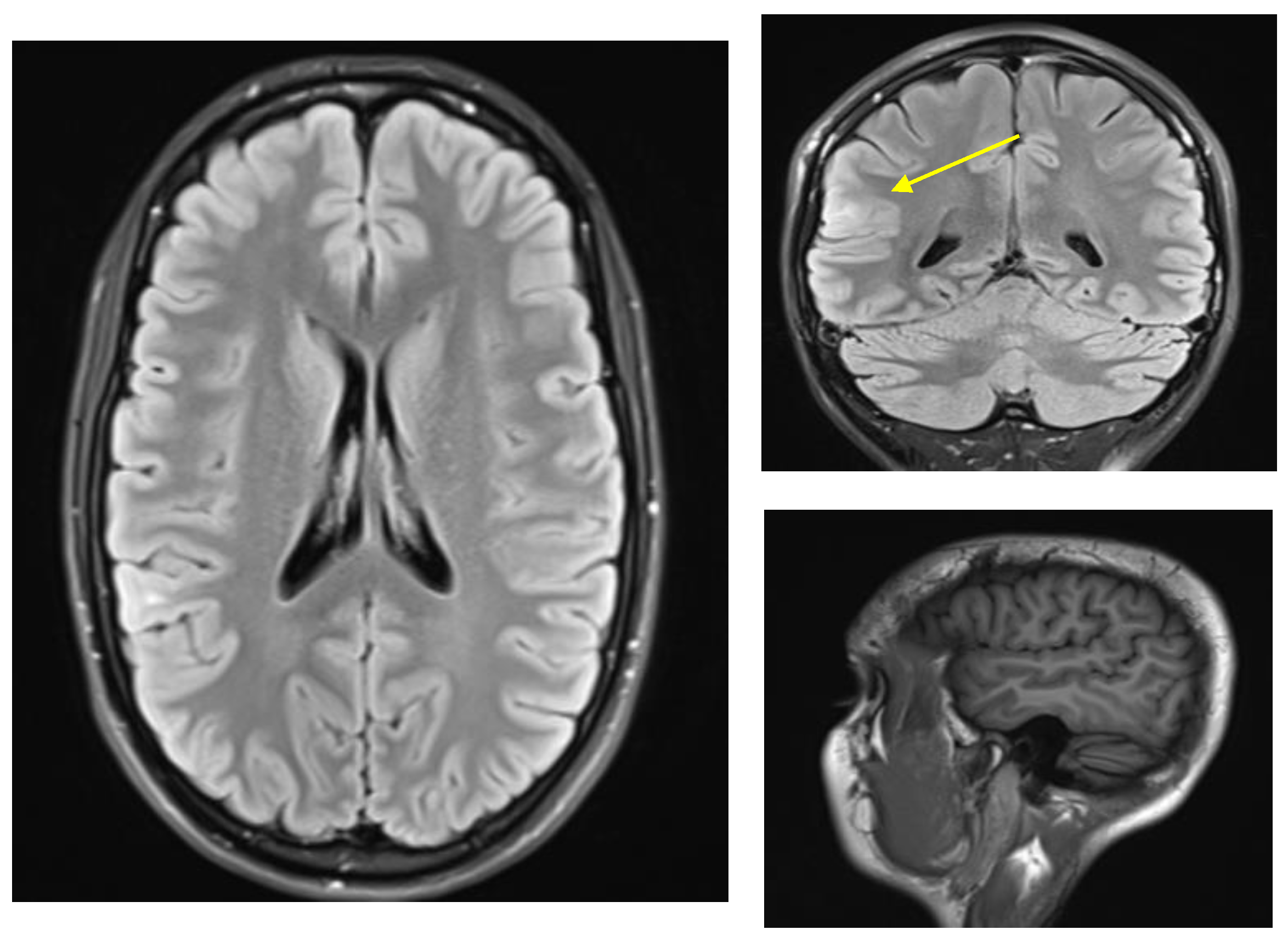 life-free-full-text-the-possibility-of-eidetic-memory-in-a-patient