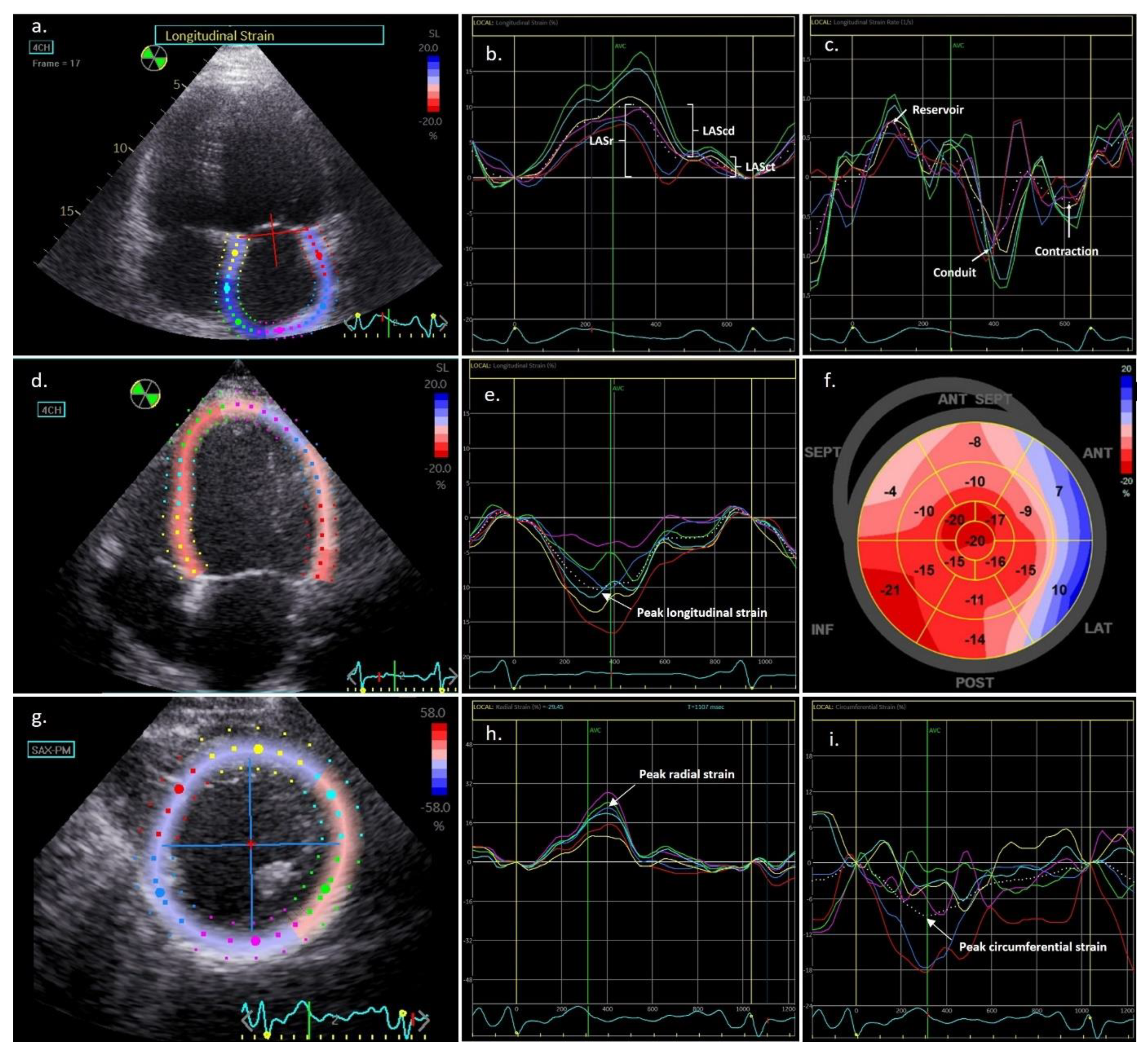 A Test in Context: Myocardial Strain Measured by Speckle-Tracking