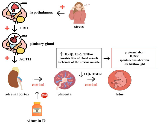 Life | Free Full-Text | Stress of Prematurity in the Experience of the ...