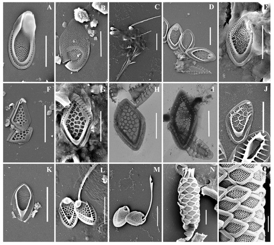Luticola tenera sp. nov. (Diadesmidaceae, Naviculales)—A New Diatom from  the Soil of the State Nature Reserve “Bastak” (Jewish Autonomous Region,  Russia)