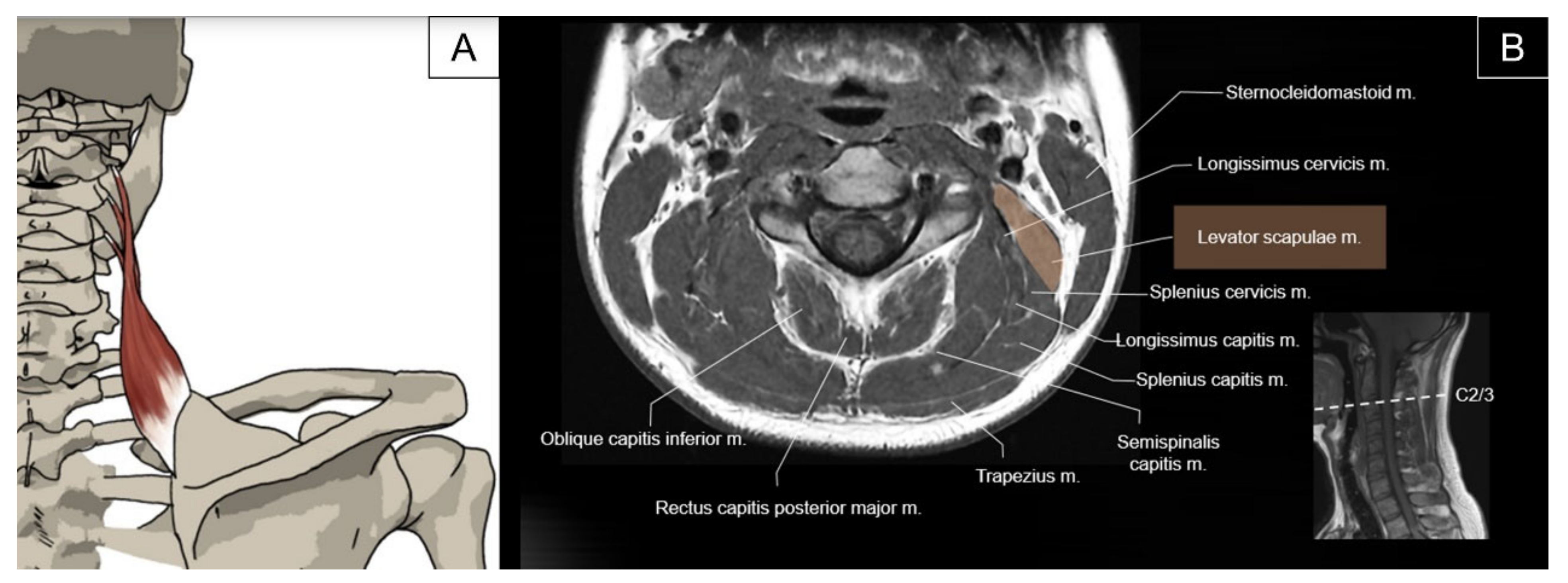 Pictorial Essay On Ultrasound And Magnetic Resonance Imaging Of Pictorial Essay On Ultrasound And Magnetic Resonance Imaging Of
