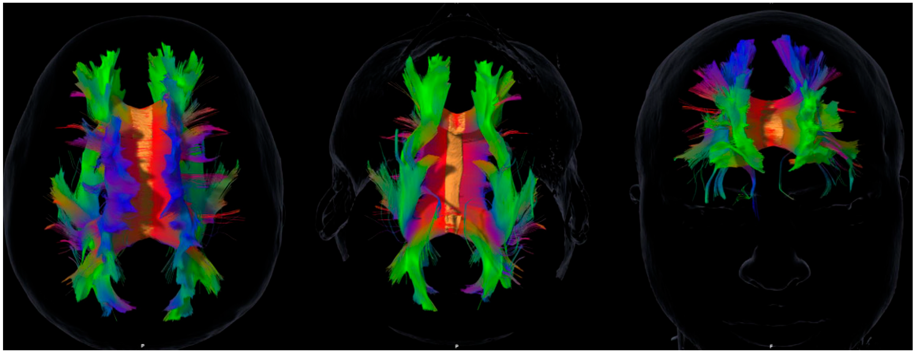 White Matter Tract Integrity and Cognitive, Emotional, and Social ...