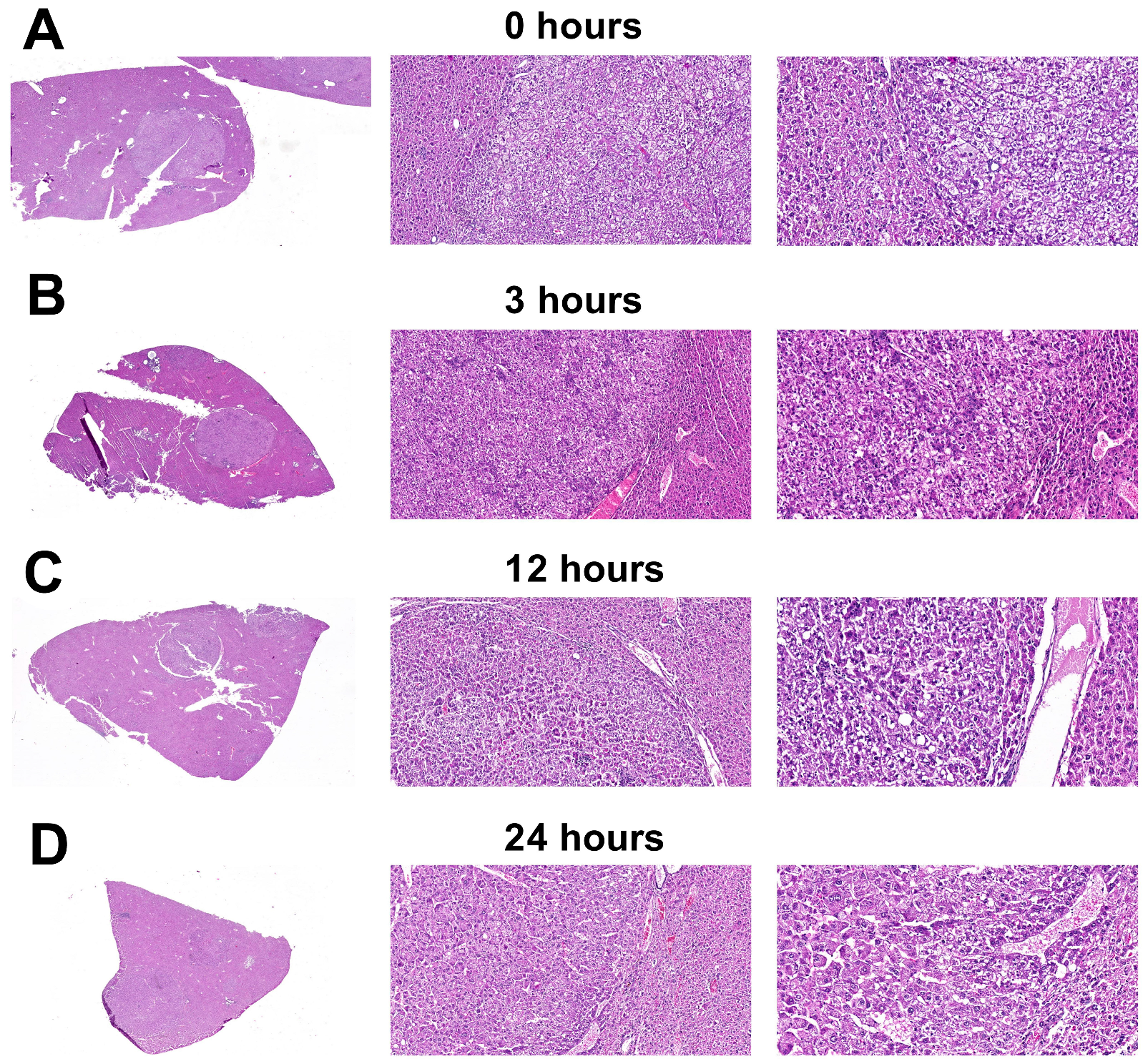 Dynamics of Postmortem Gene Expression in Normal and Neoplastic Murine ...