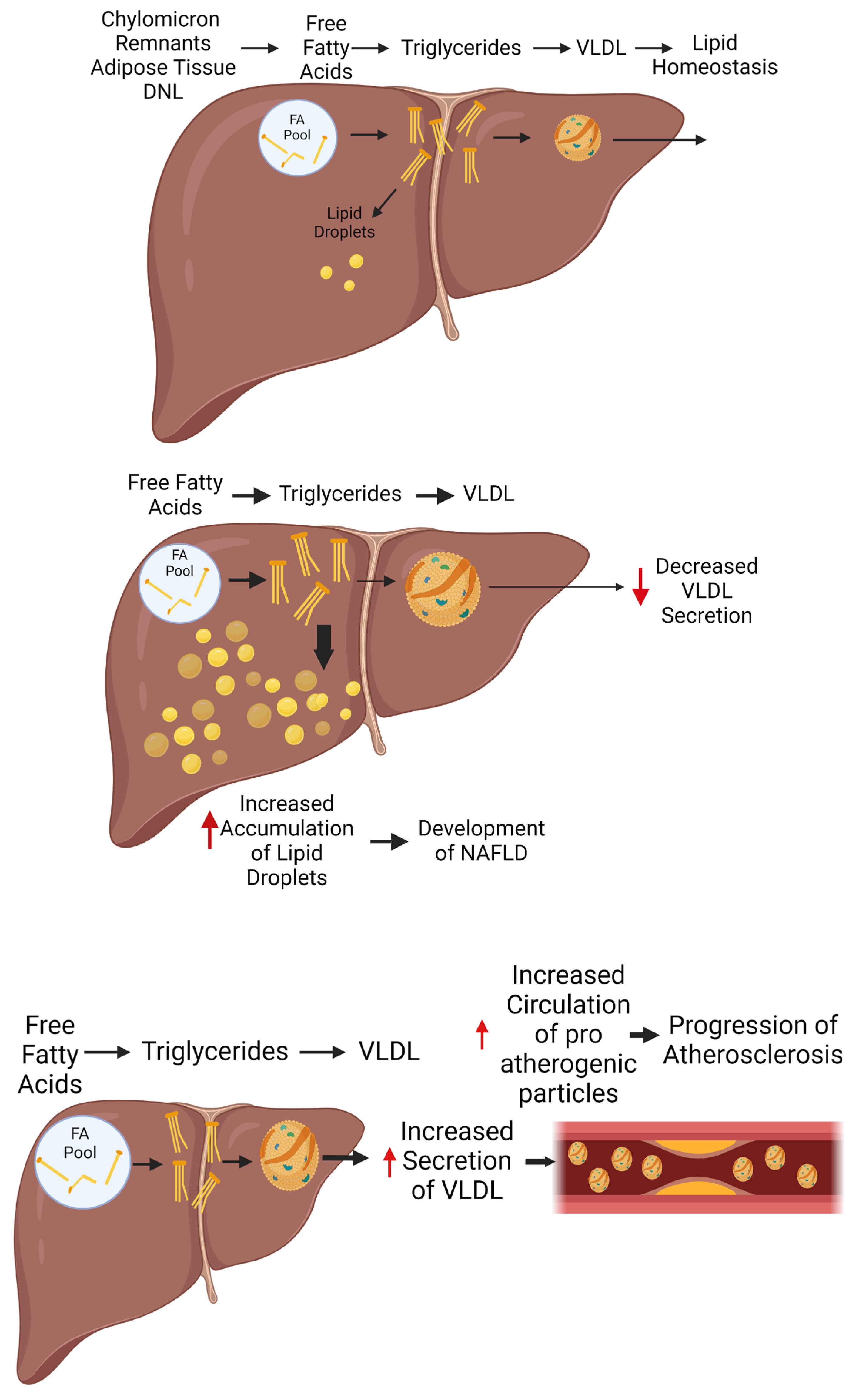 The Liver at the Crossroads: Orchestrating Lipoprotein Dynamics and ...
