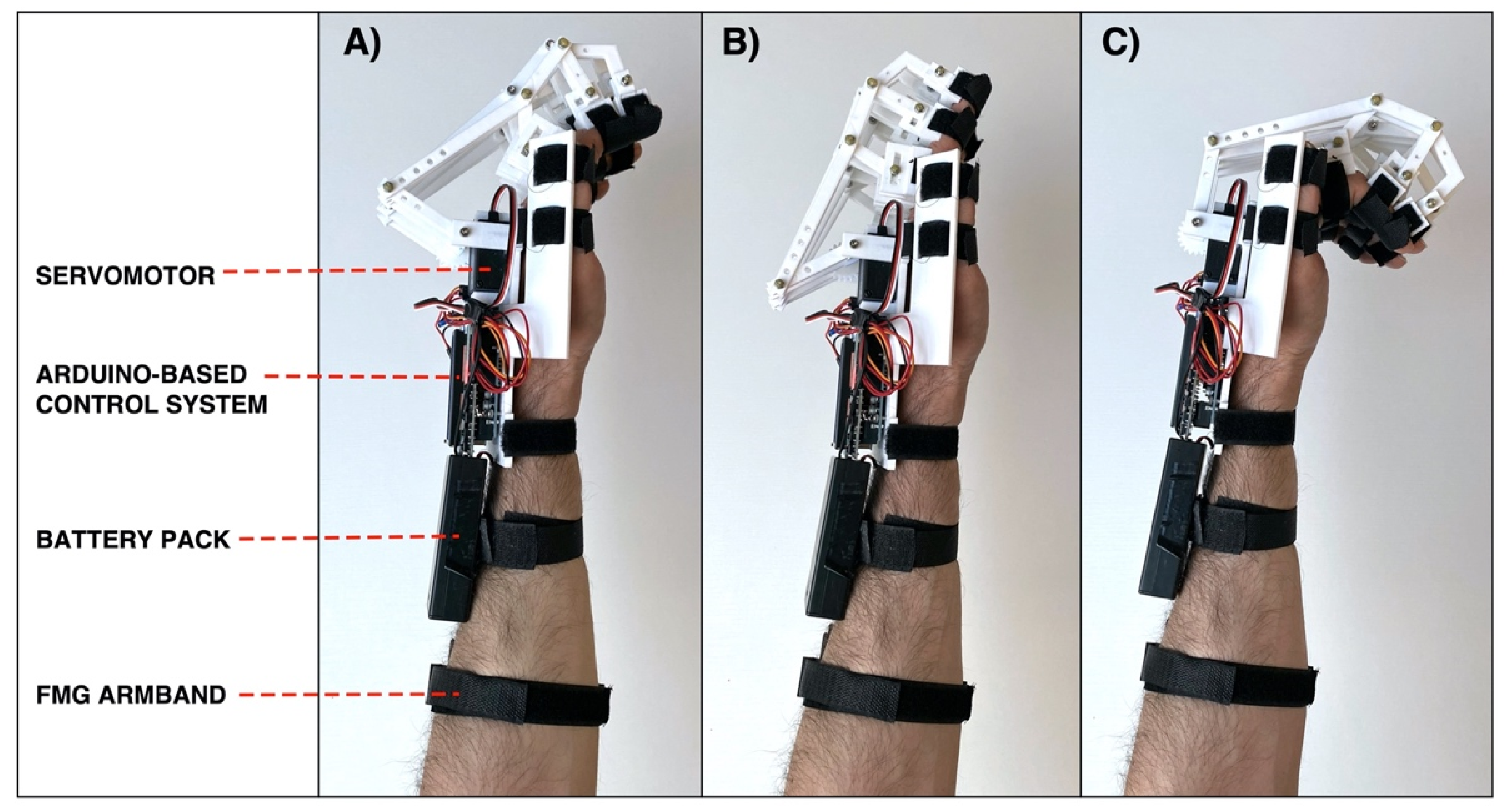 | Free Full-Text | Design a 3D-Printed Hand Exoskeleton Based on for Assistance and Rehabilitation