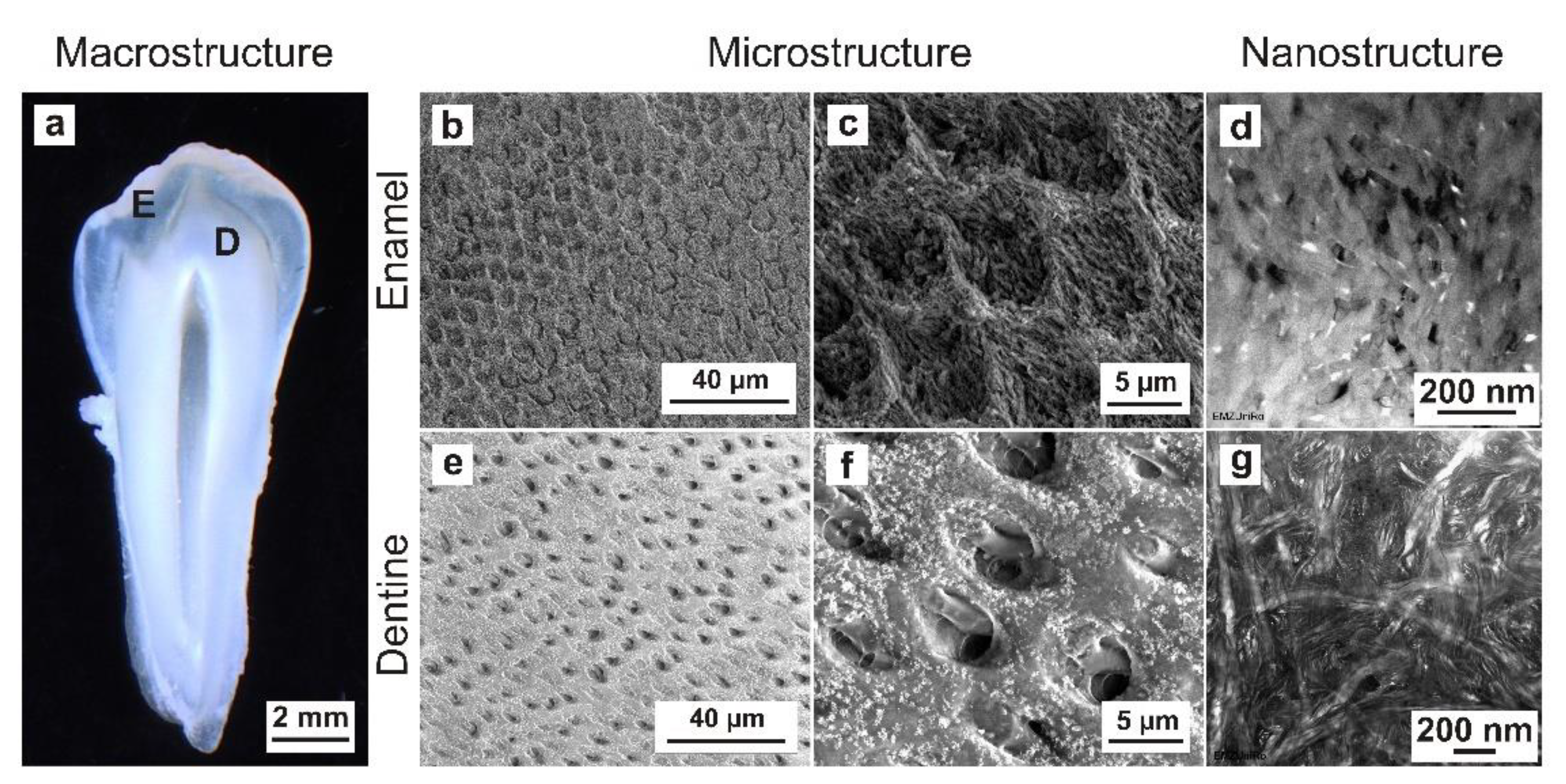 Light micrographs showing several regions of the dentin-pulp interface