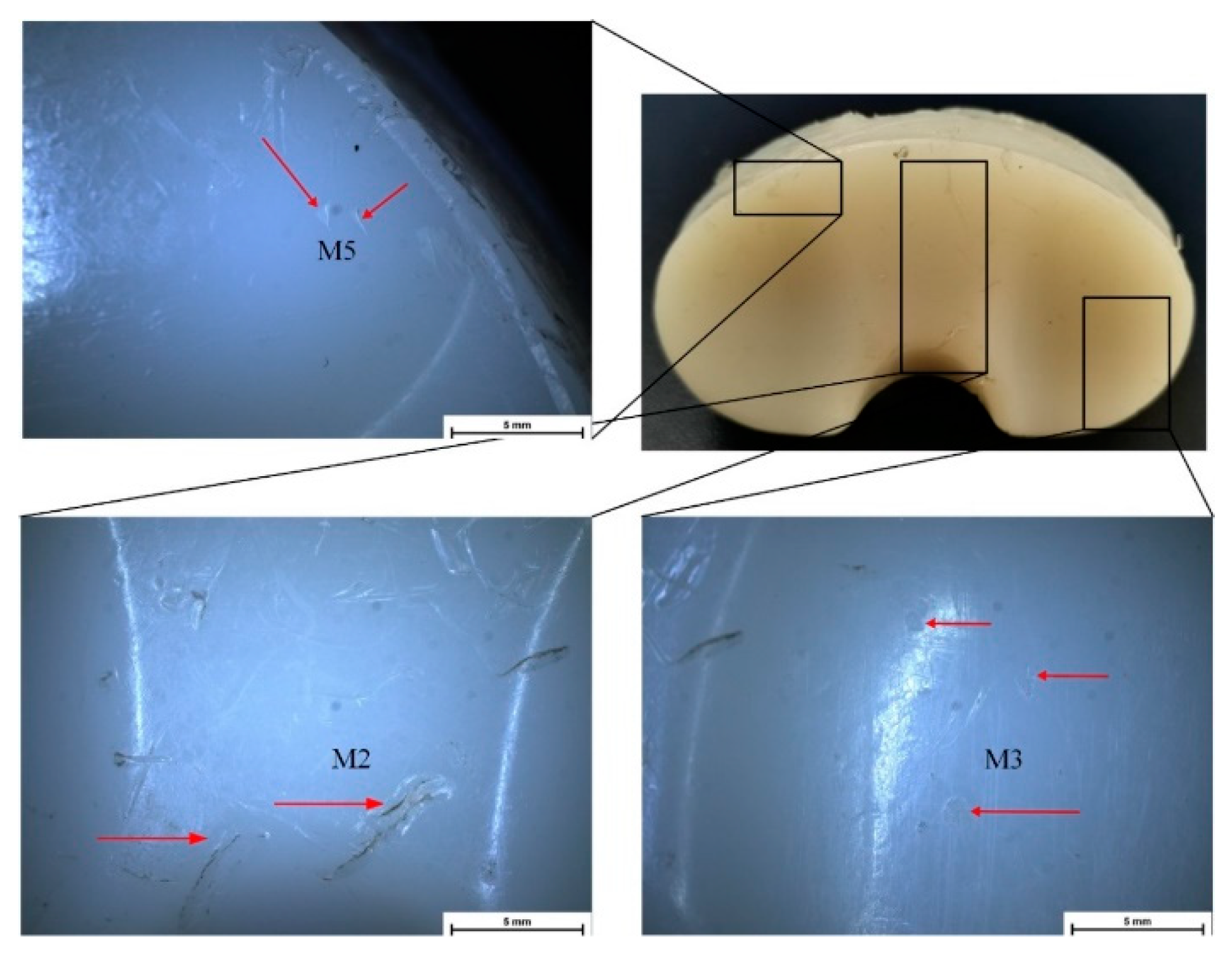 Comparative Analysis of Contemporary Fixed Tibial Inserts: A